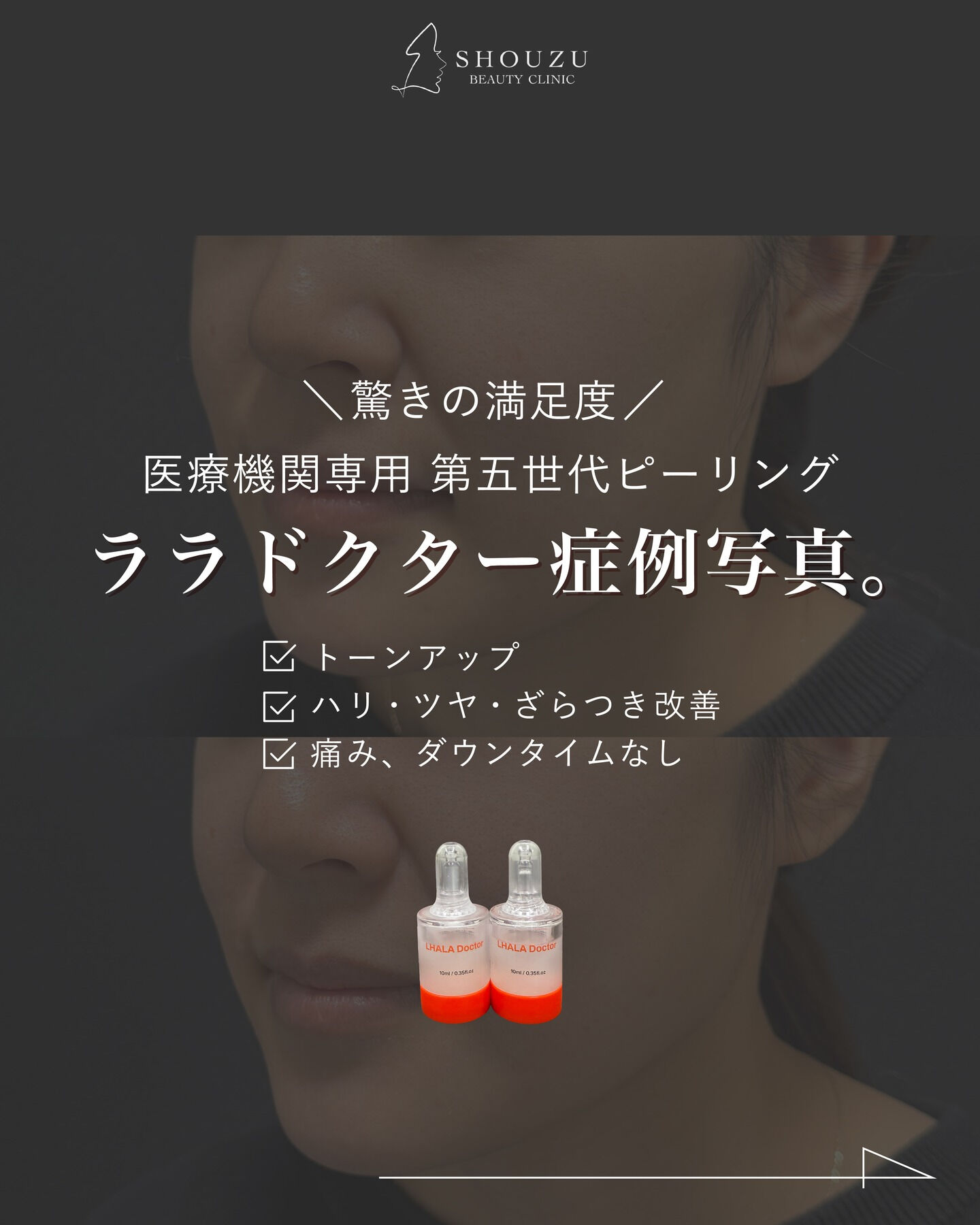 .大人気ピーリング