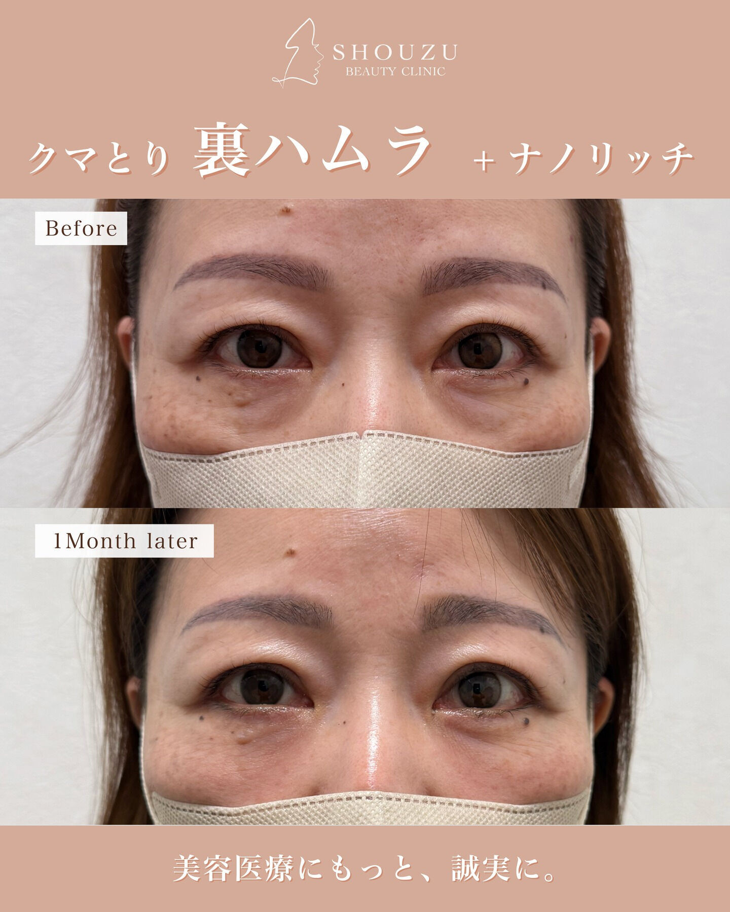 .女性 50代のモニターのお客様です