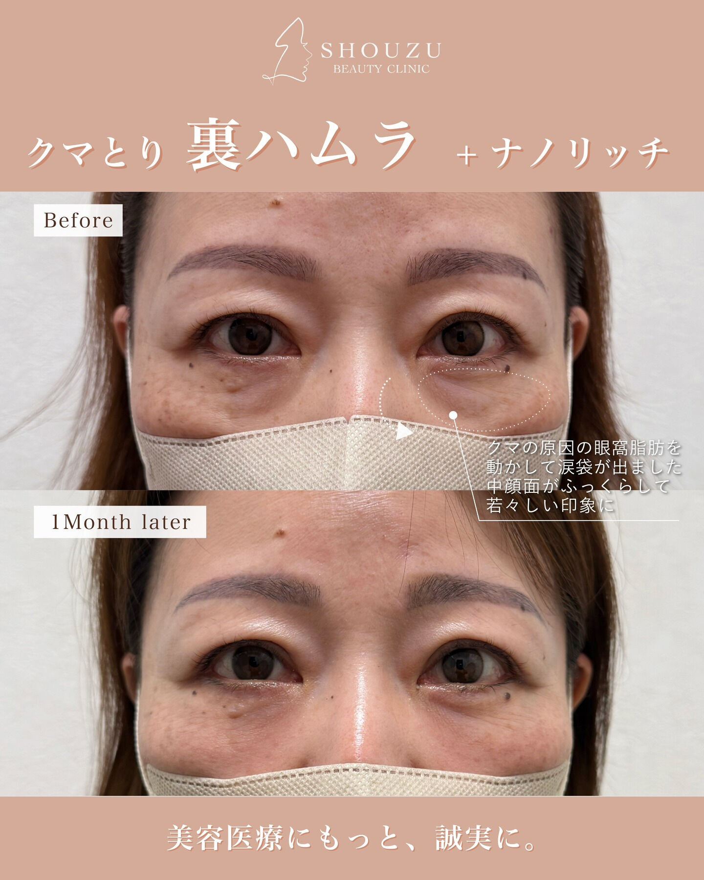 .女性 50代のモニターのお客様です