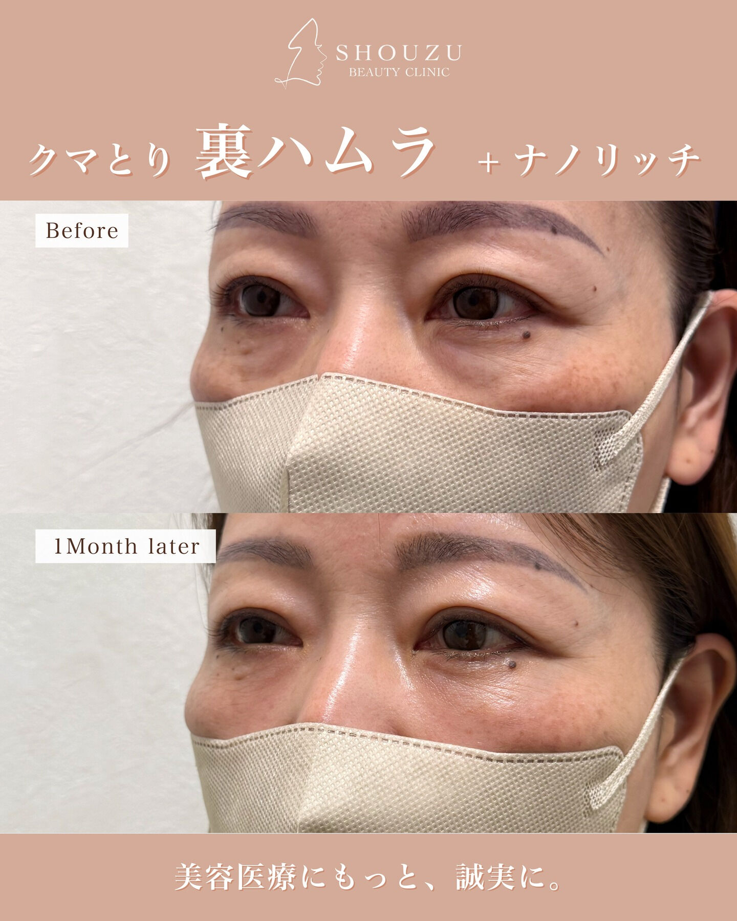 .女性 50代のモニターのお客様です