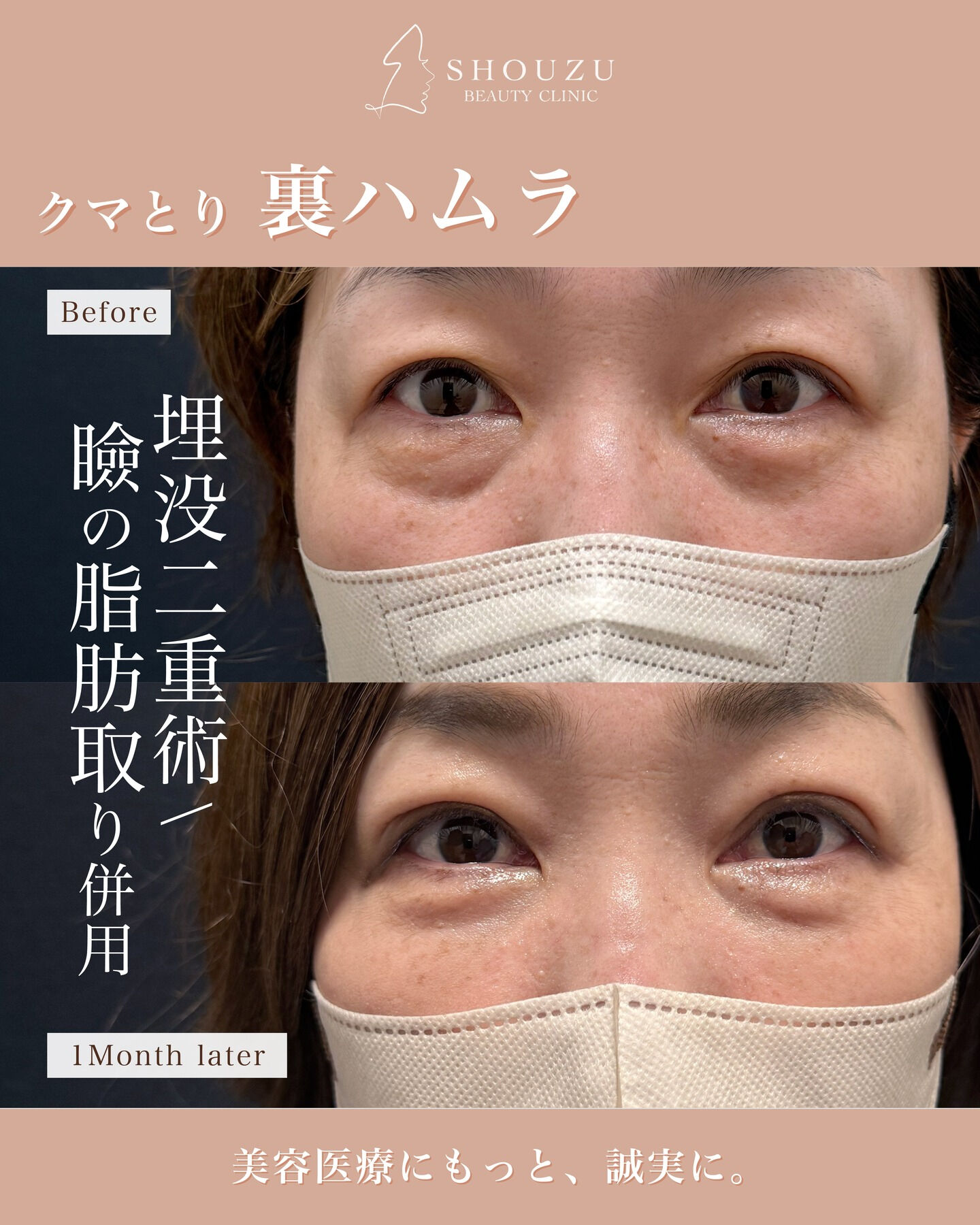 .40代 女性 モニターのお客様です