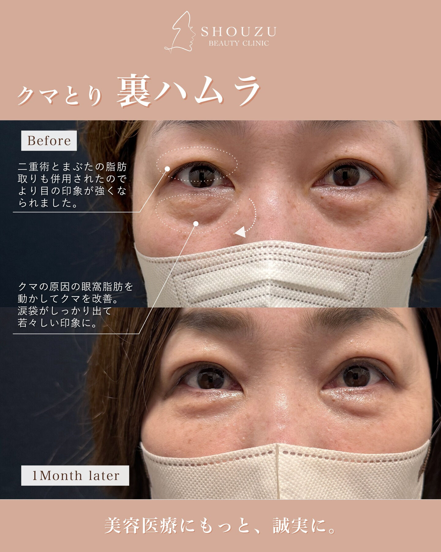 .40代 女性 モニターのお客様です