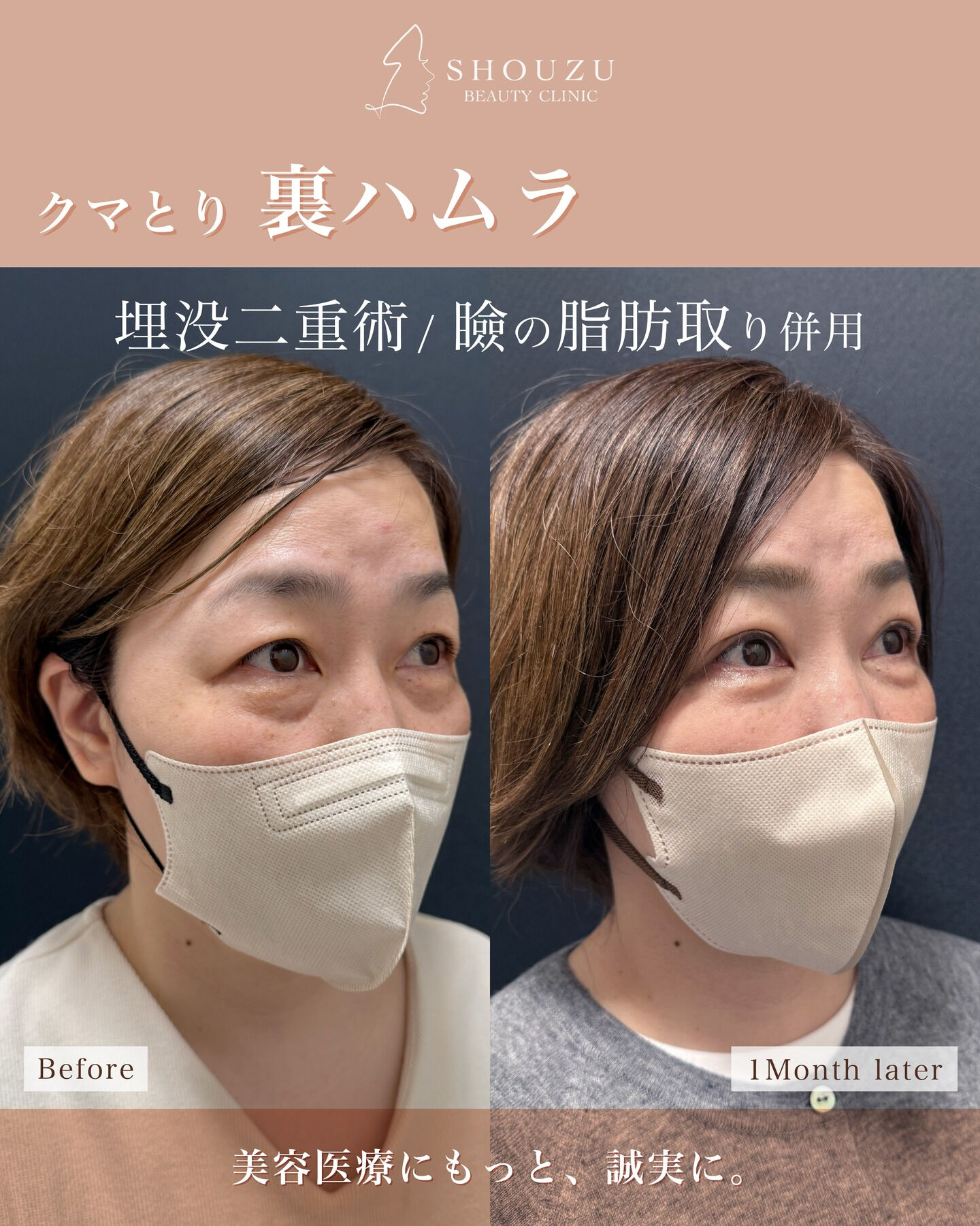 .40代 女性 モニターのお客様です