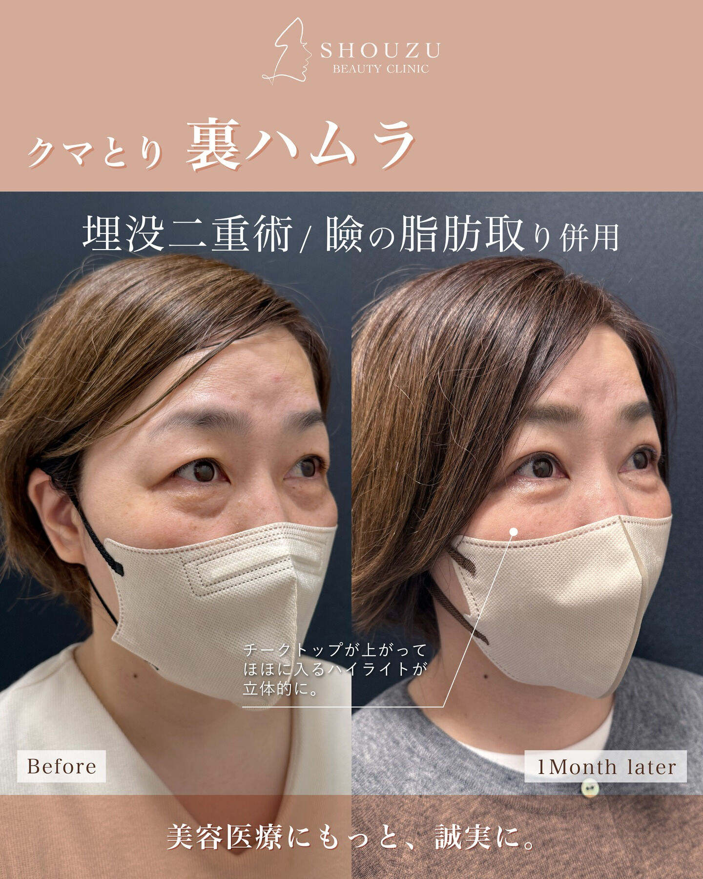 .40代 女性 モニターのお客様です