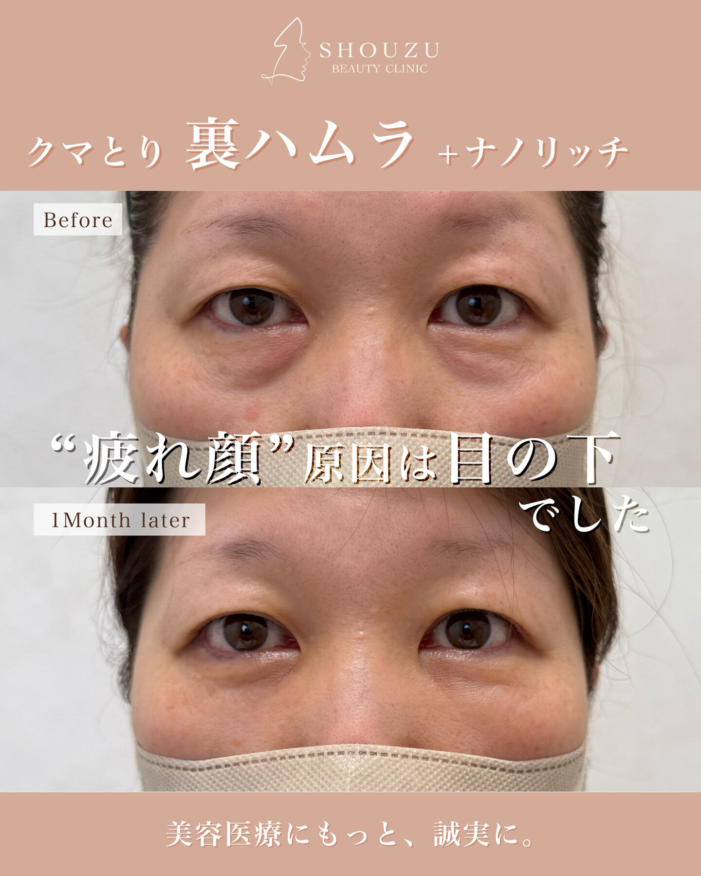50代 女性 モニターのお客様です