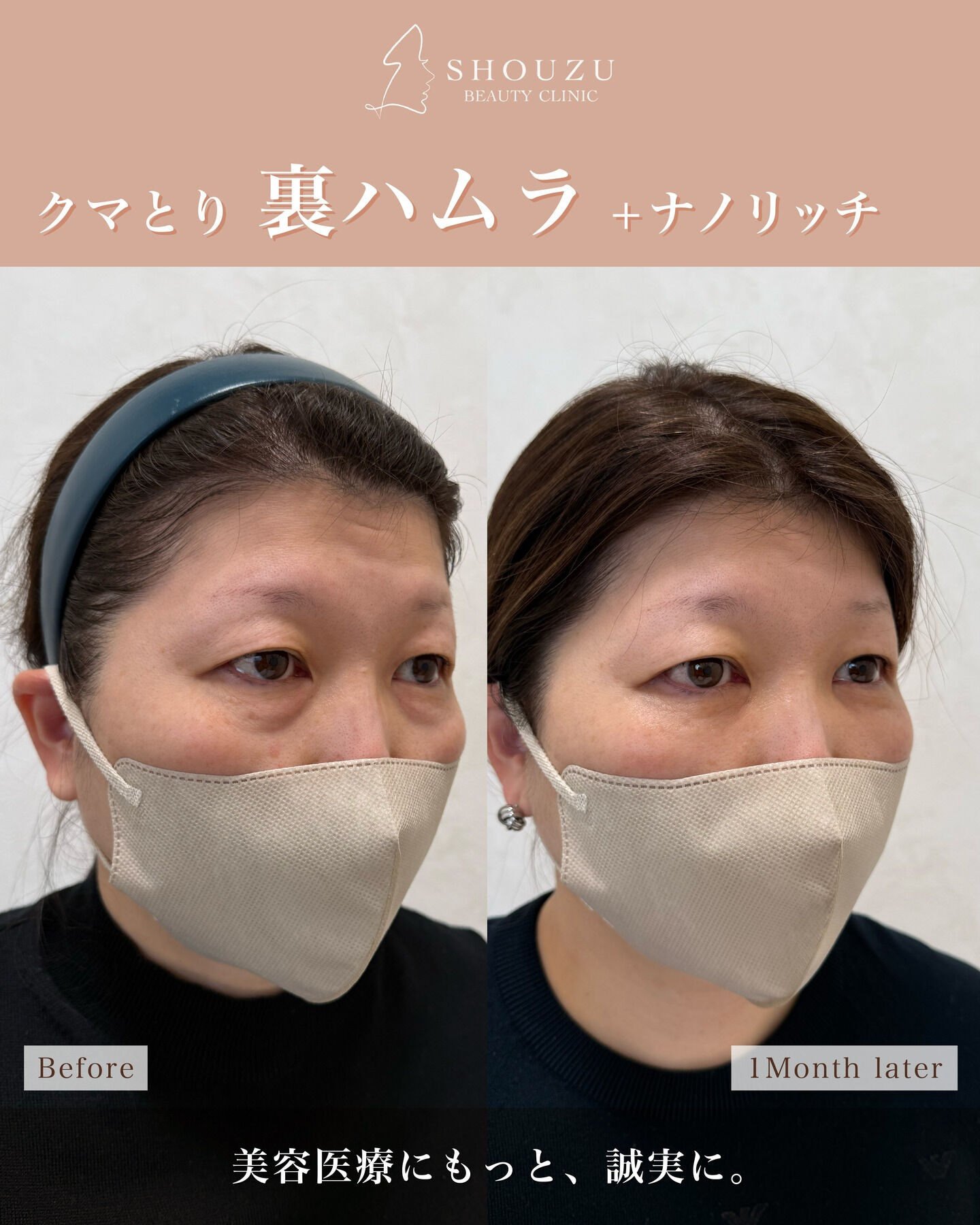 50代 女性 モニターのお客様です