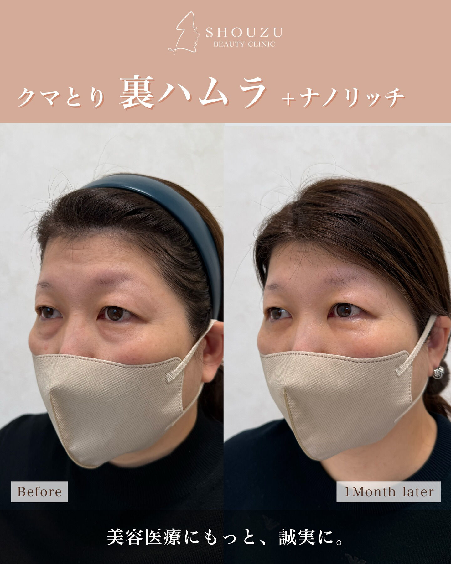 50代 女性 モニターのお客様です