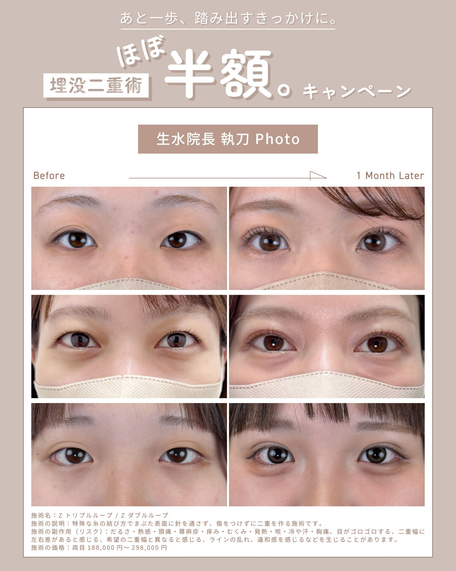 .新春🎍二重術 キャンペーン