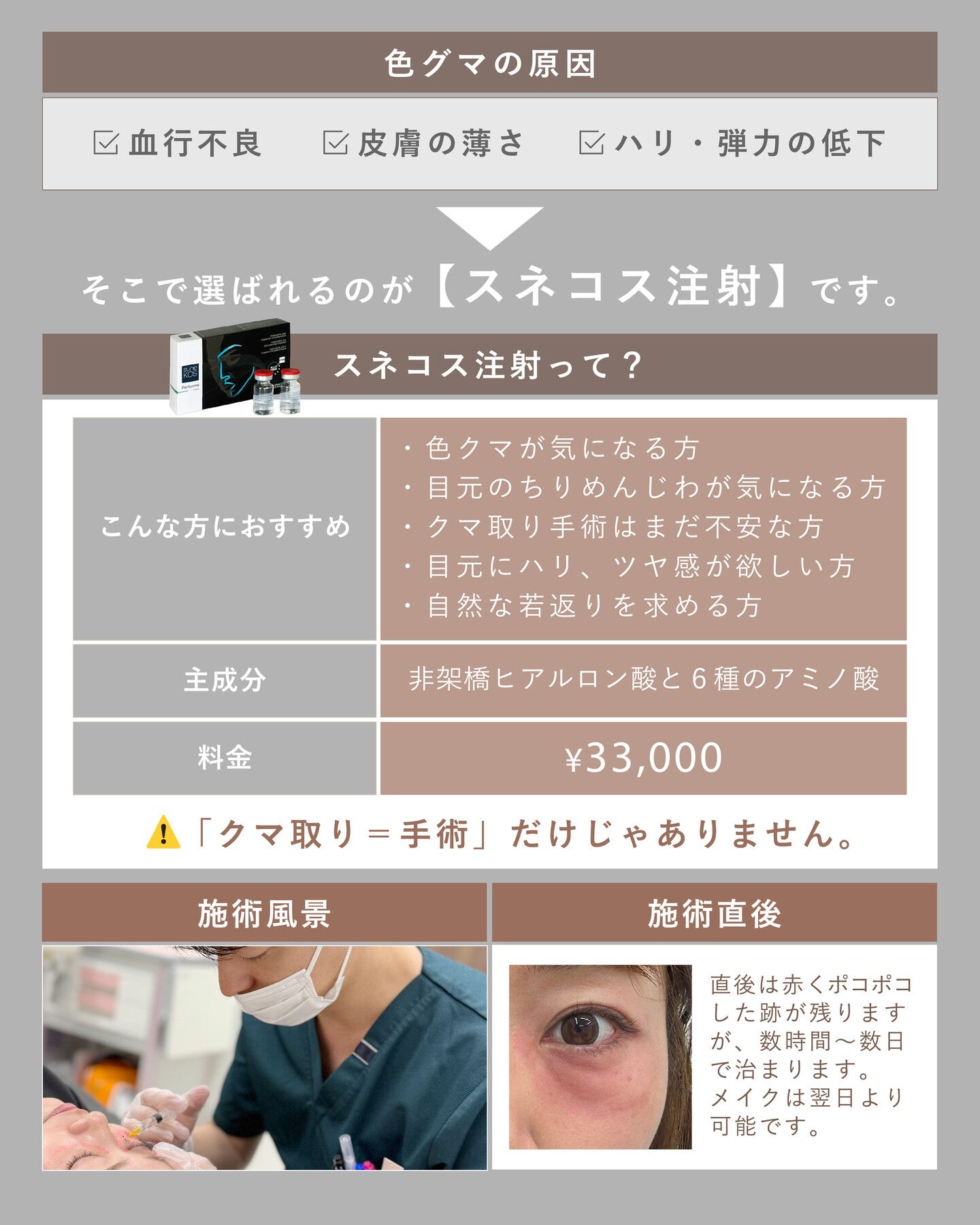 .30代のスタッフが、目元に3回スネコス注射を施術しました