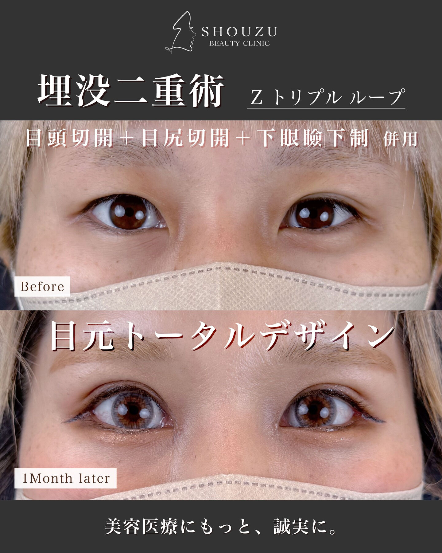 目元トータルデザイン