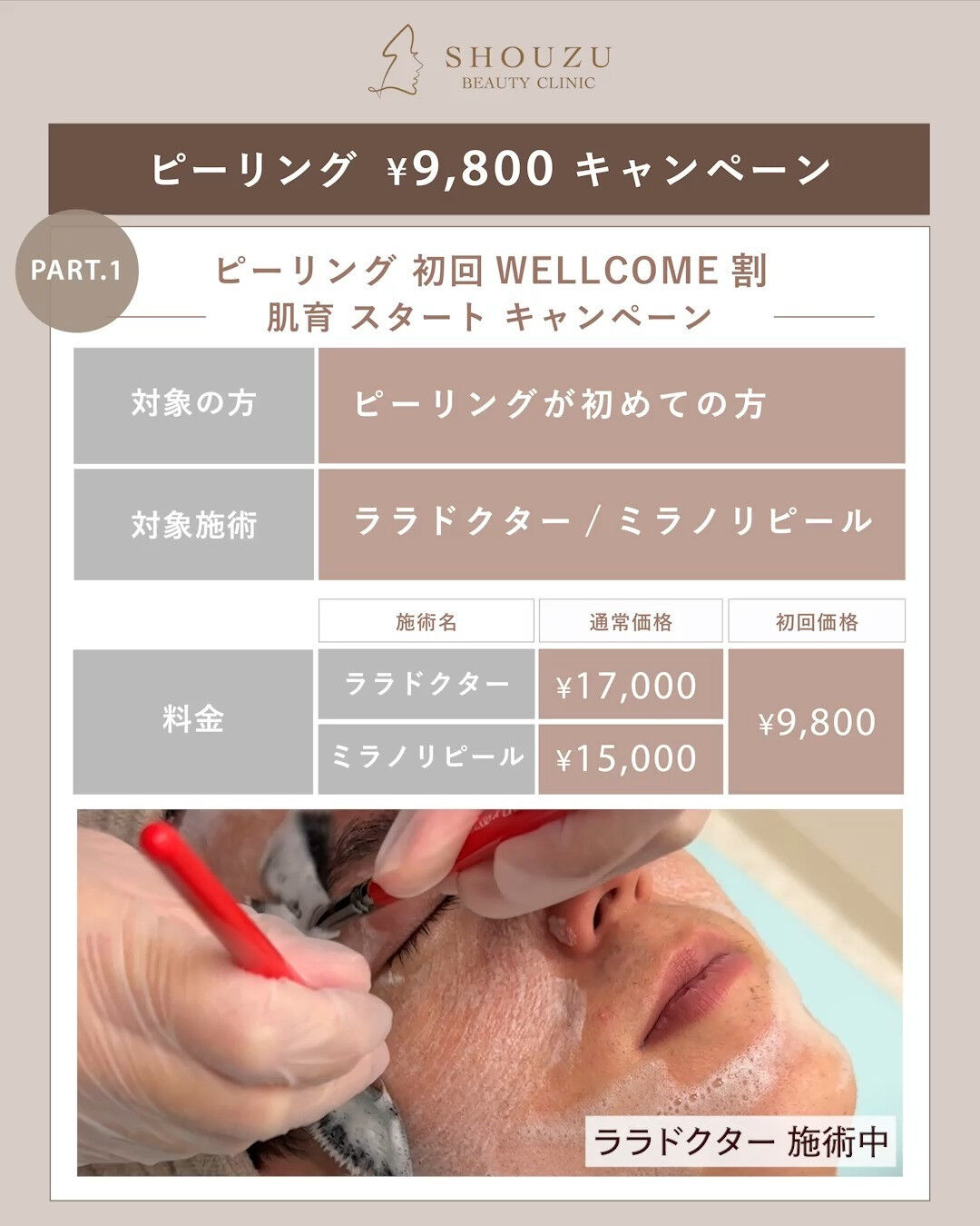 ピーリング