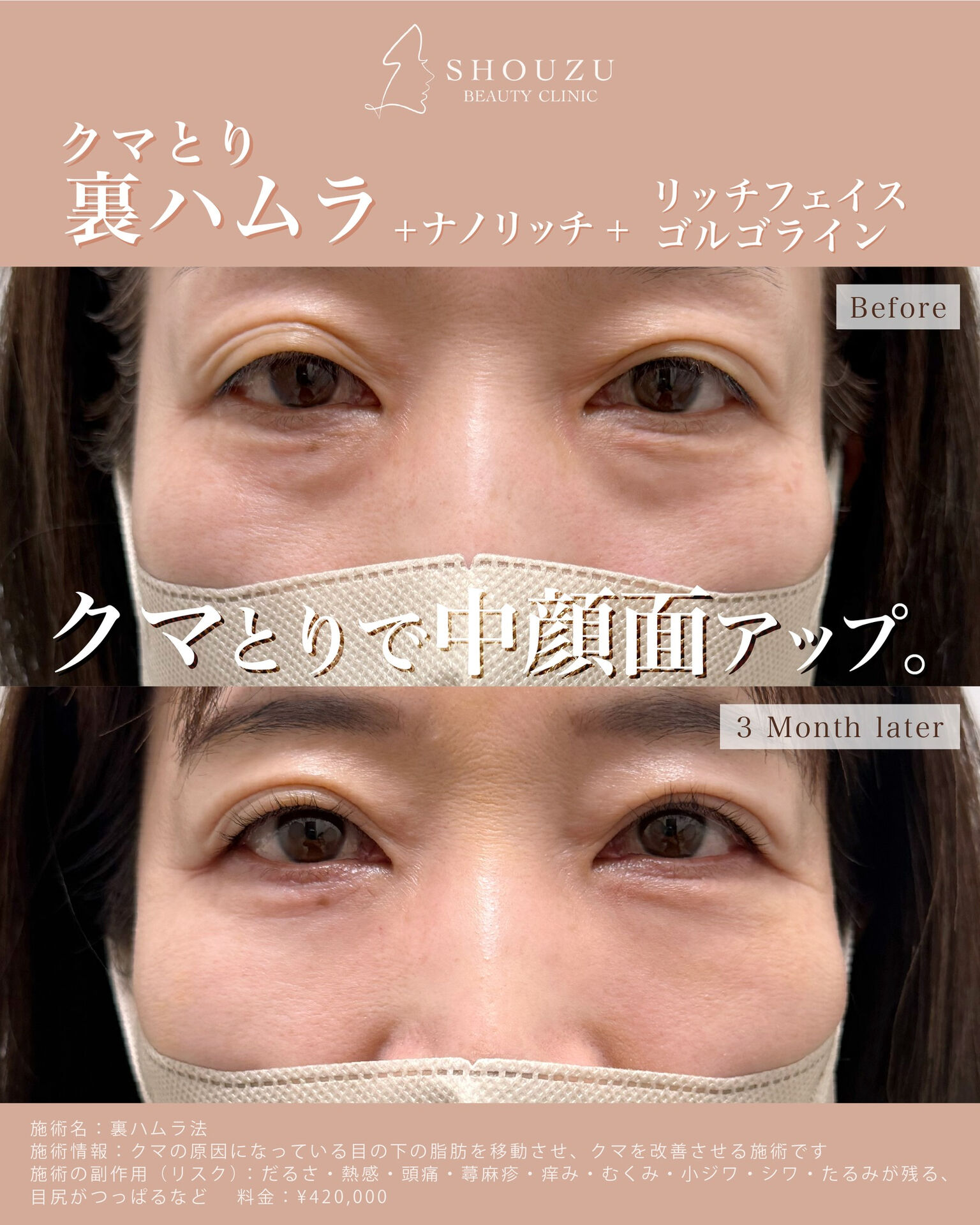 女性 50代 モニターのお客様です