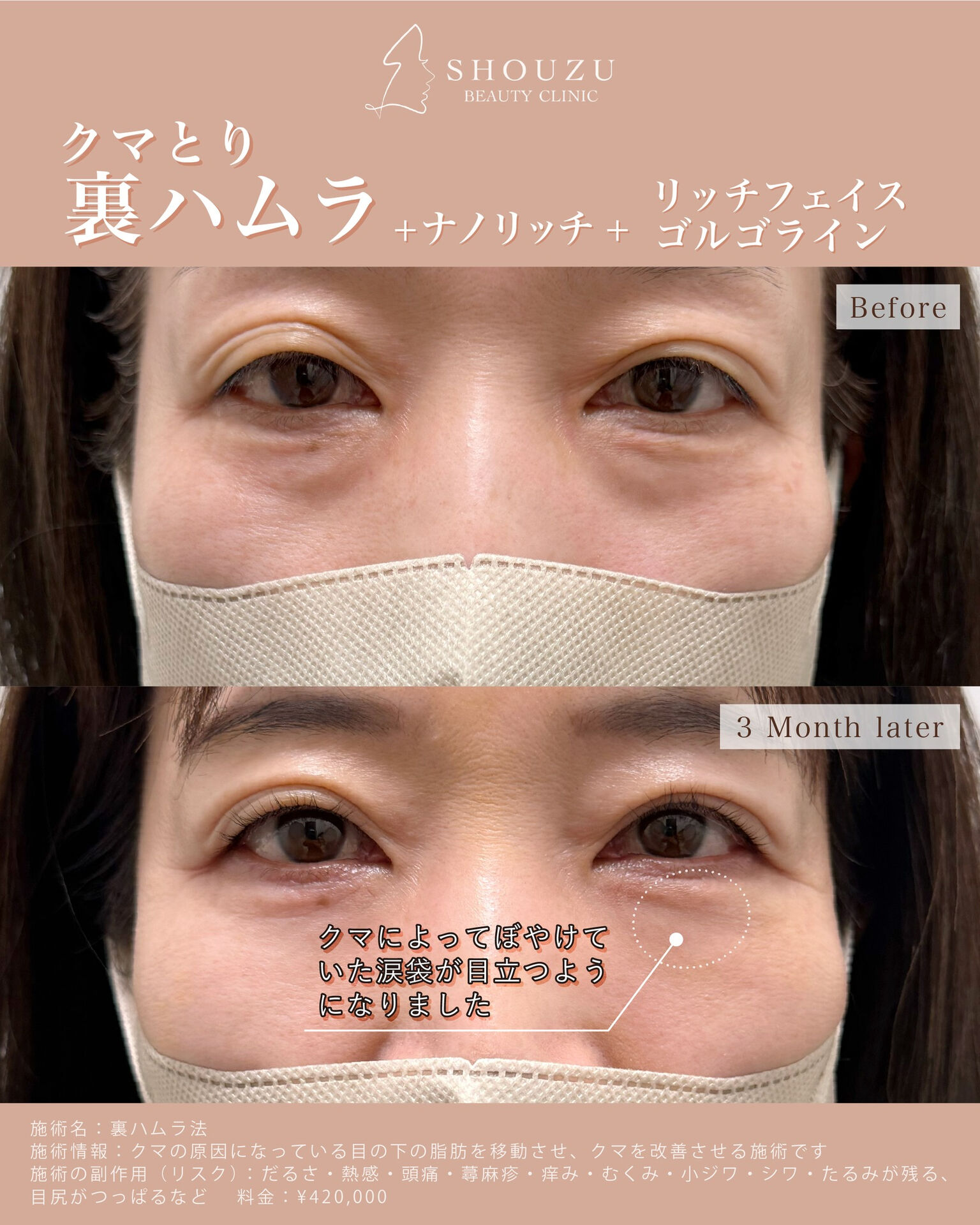 女性 50代 モニターのお客様です