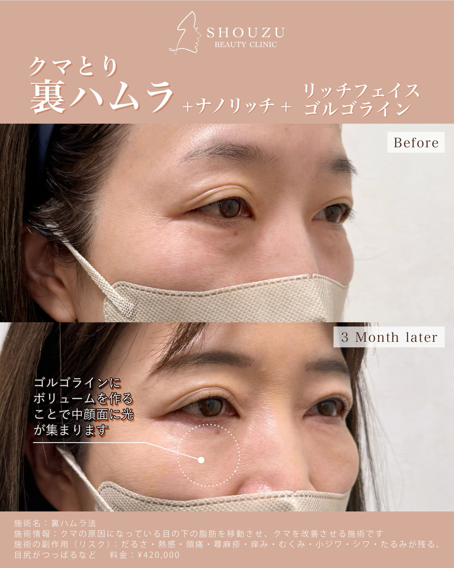女性 50代 モニターのお客様です
