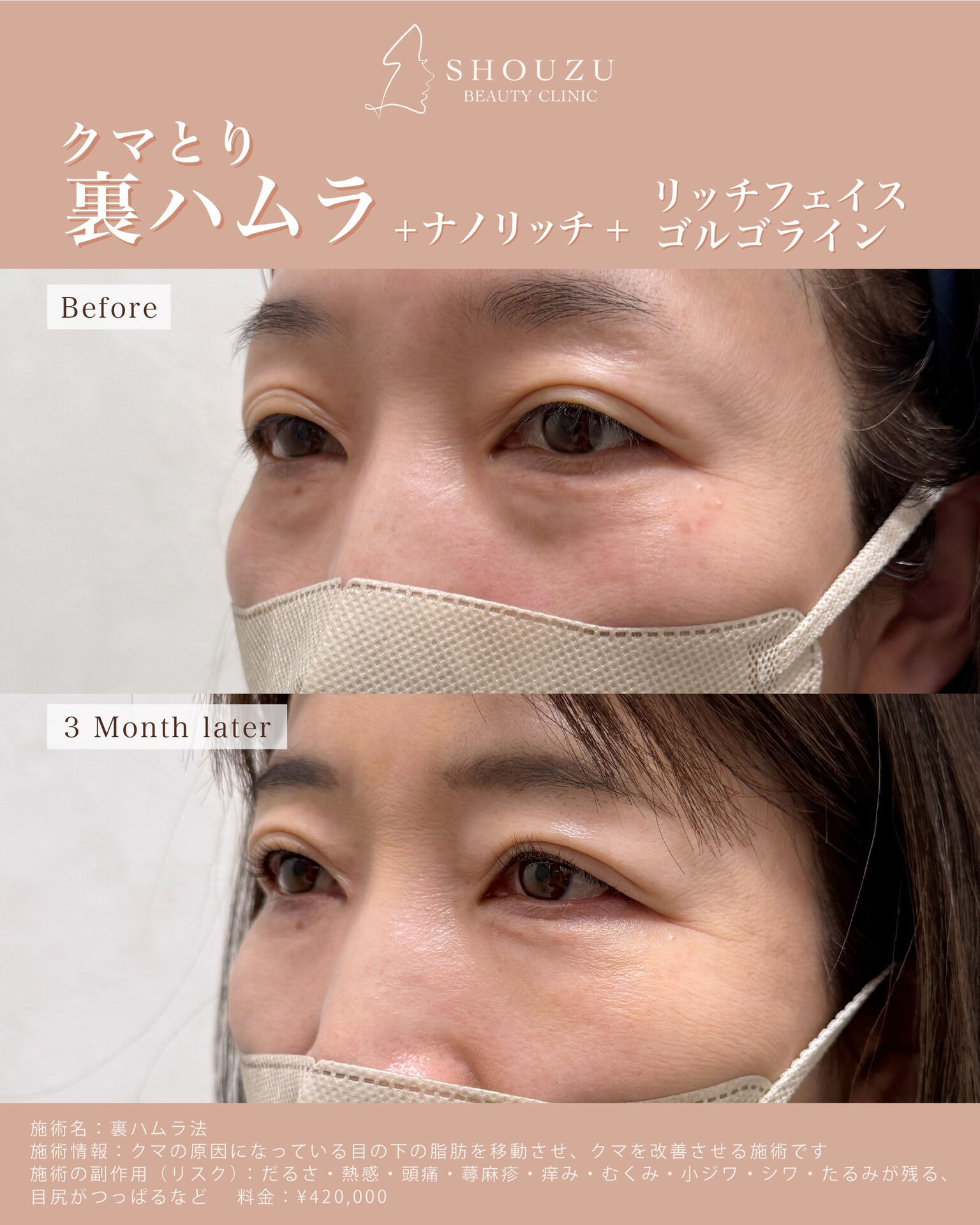 女性 50代 モニターのお客様です