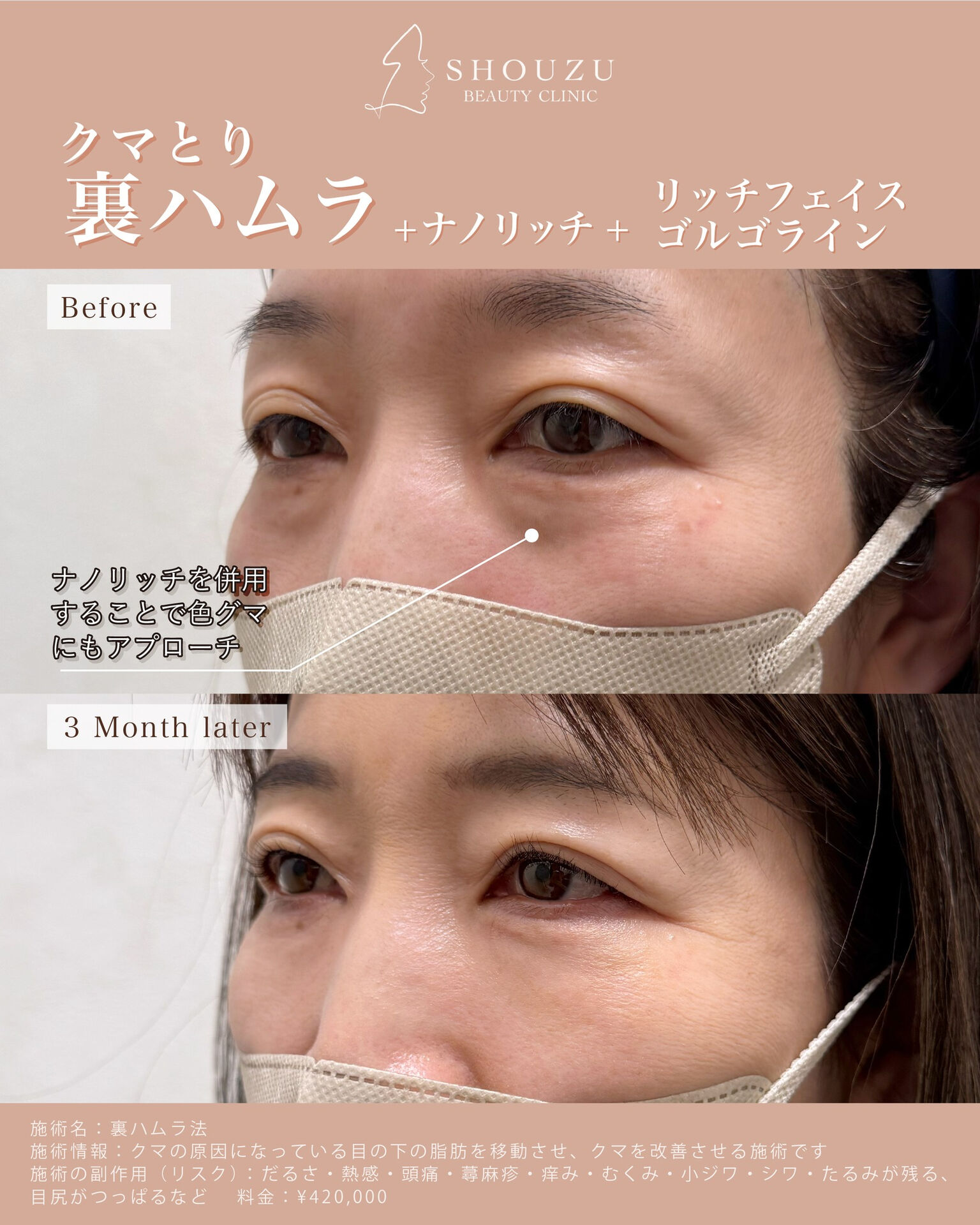 女性 50代 モニターのお客様です