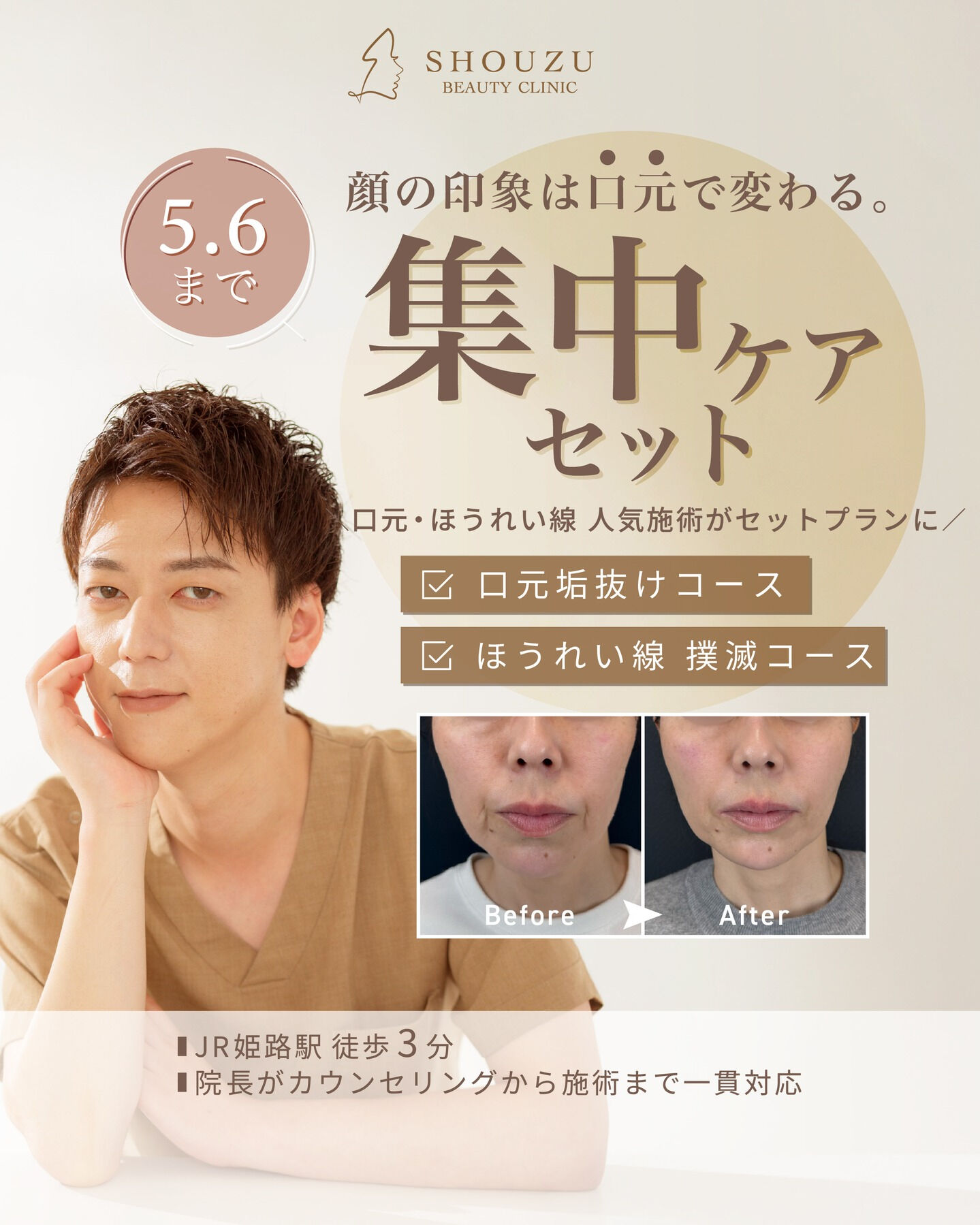 顔の印象は、口元で変わる。