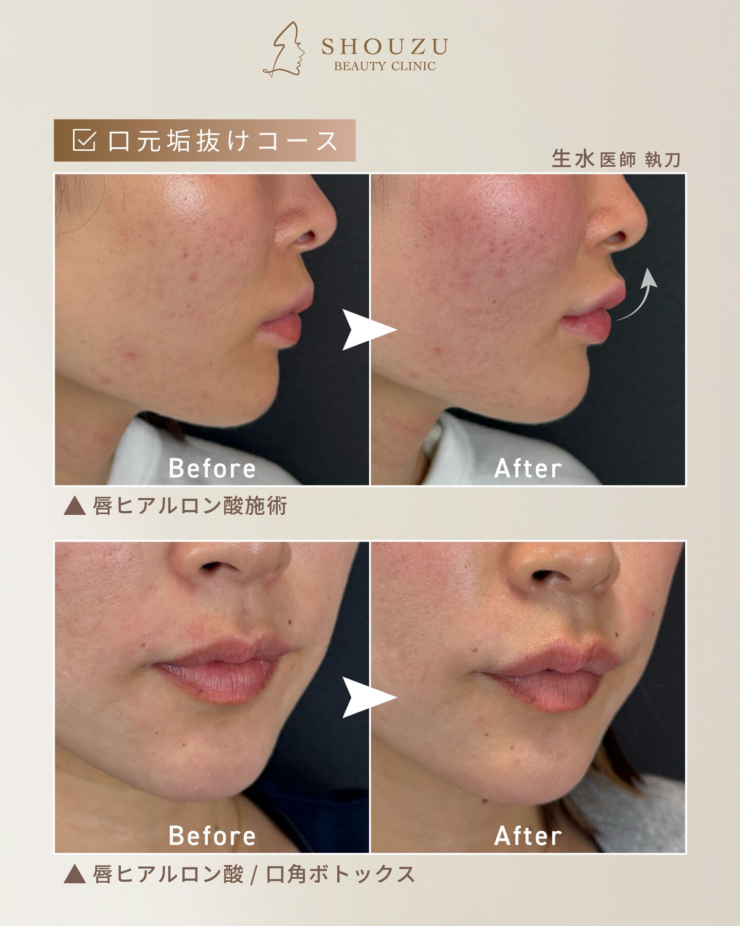 顔の印象は、口元で変わる。