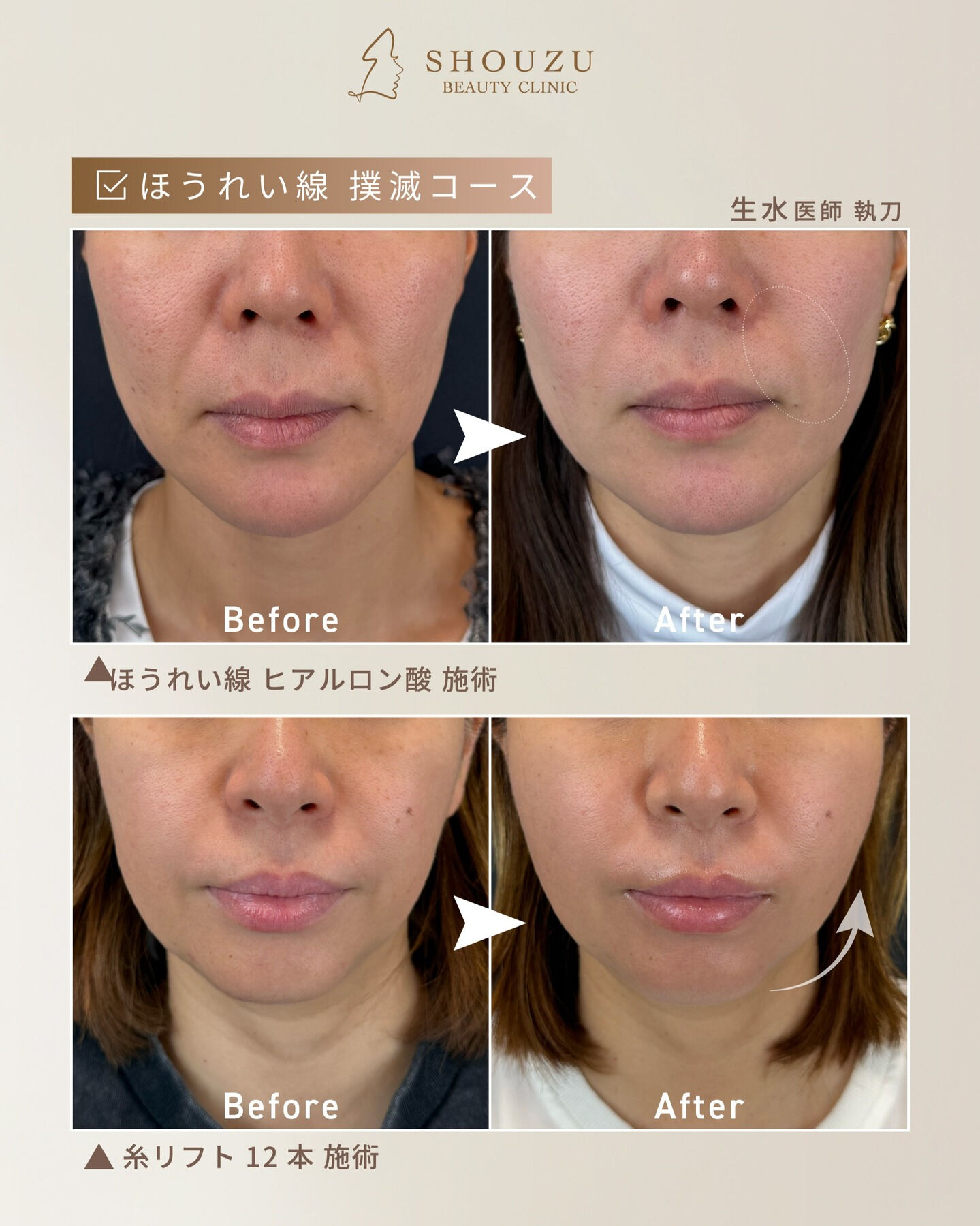 顔の印象は、口元で変わる。