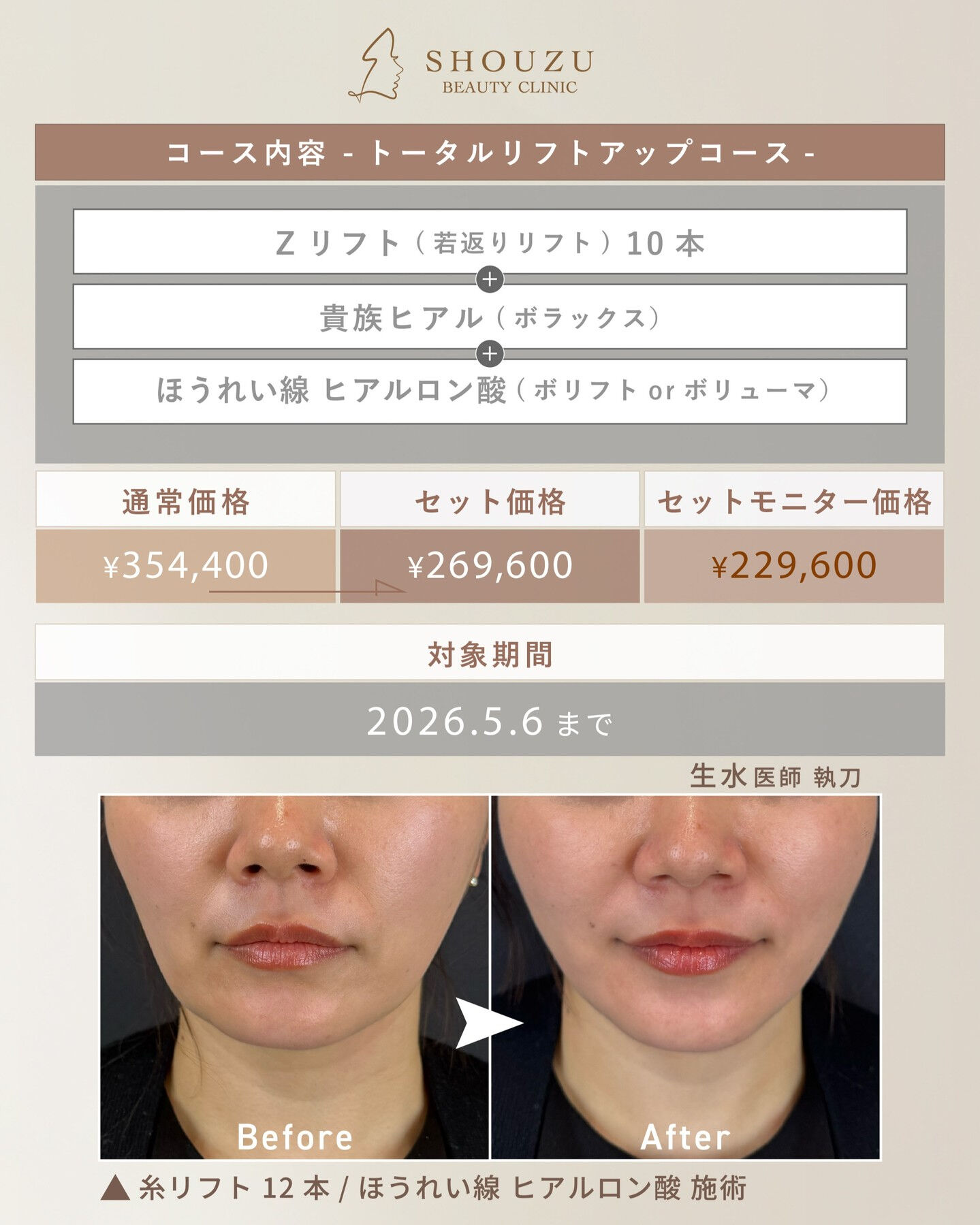 顔の印象は、口元で変わる。