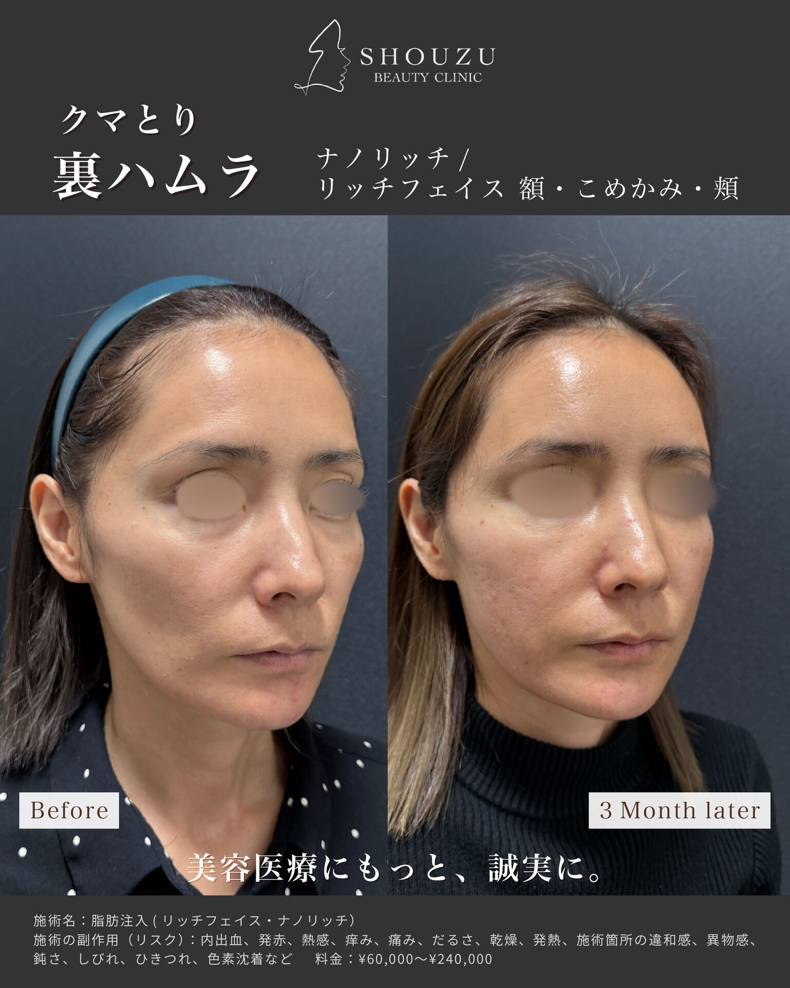 .女性 40代 モニターのお客様です