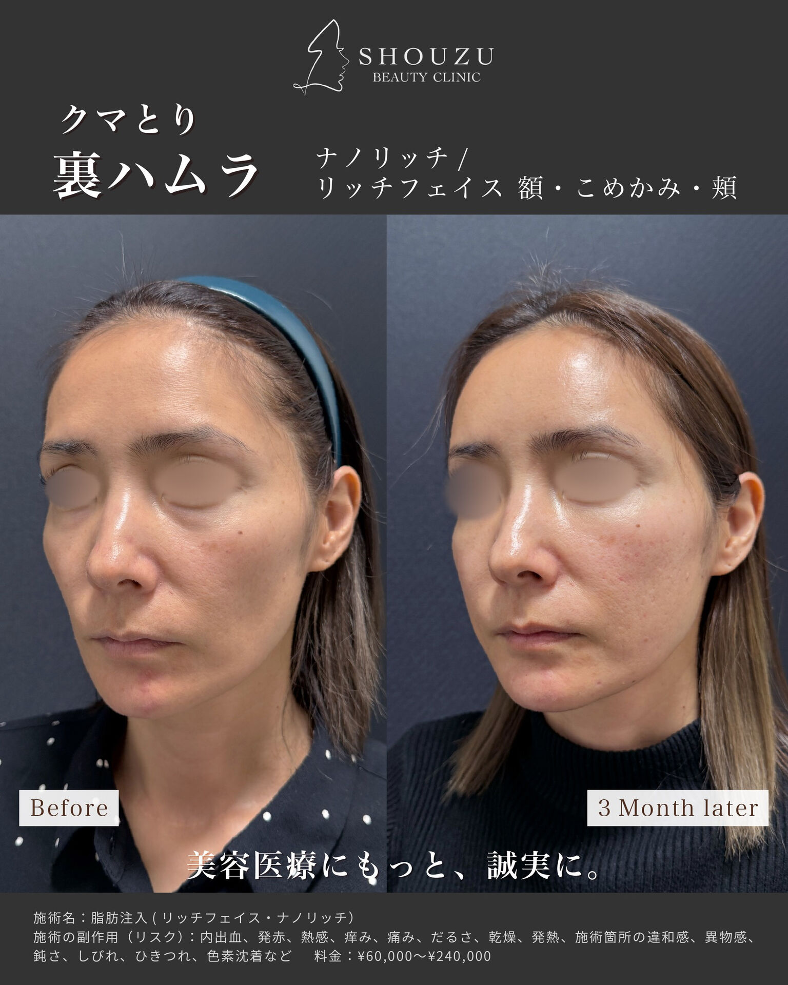 .女性 40代 モニターのお客様です