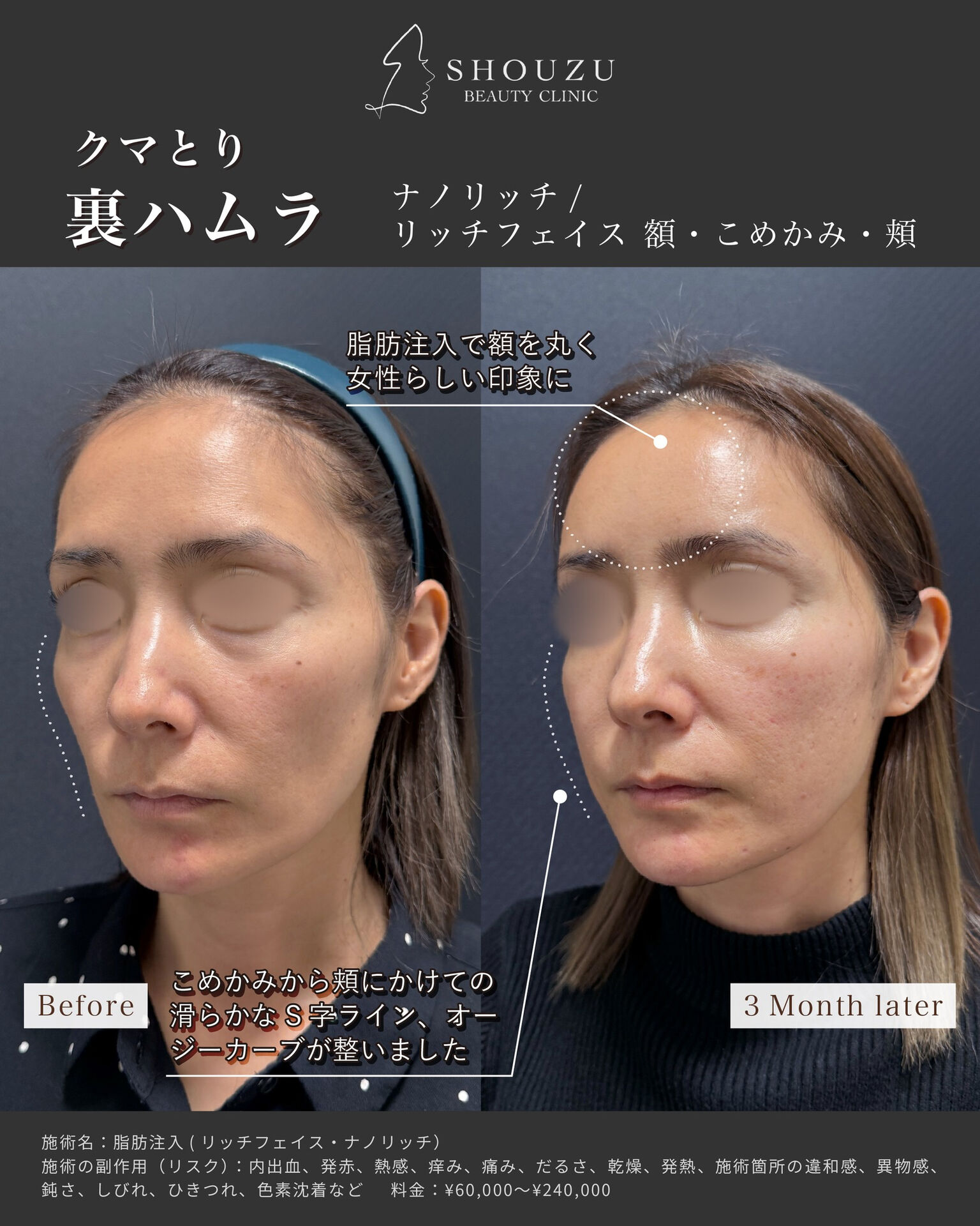 .女性 40代 モニターのお客様です