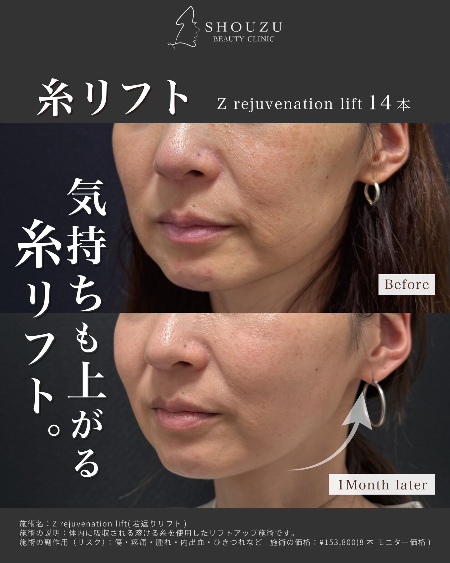 .40代 モニター様のご紹介です