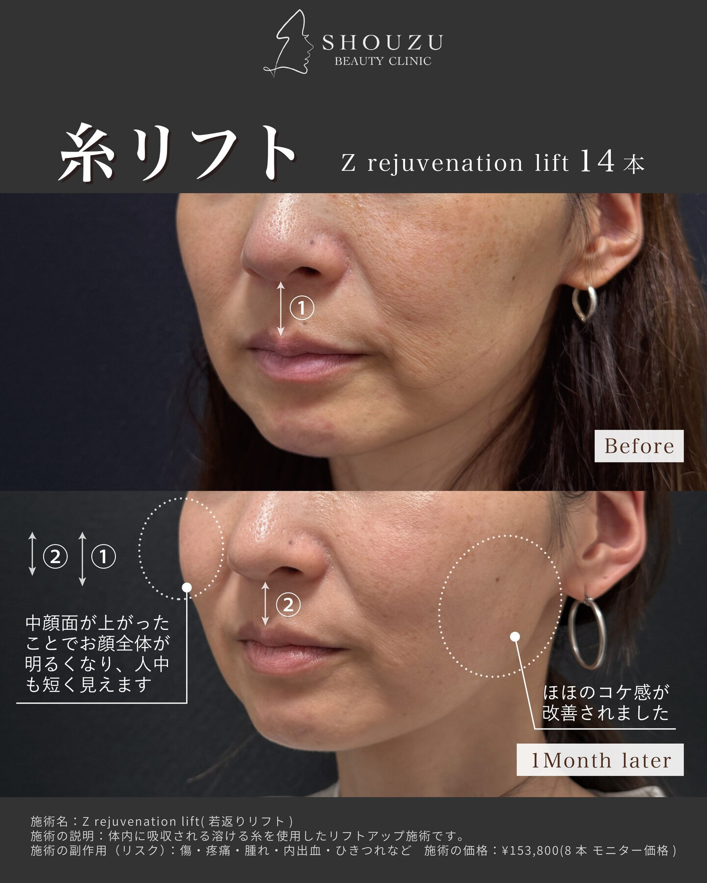 .40代 モニター様のご紹介です