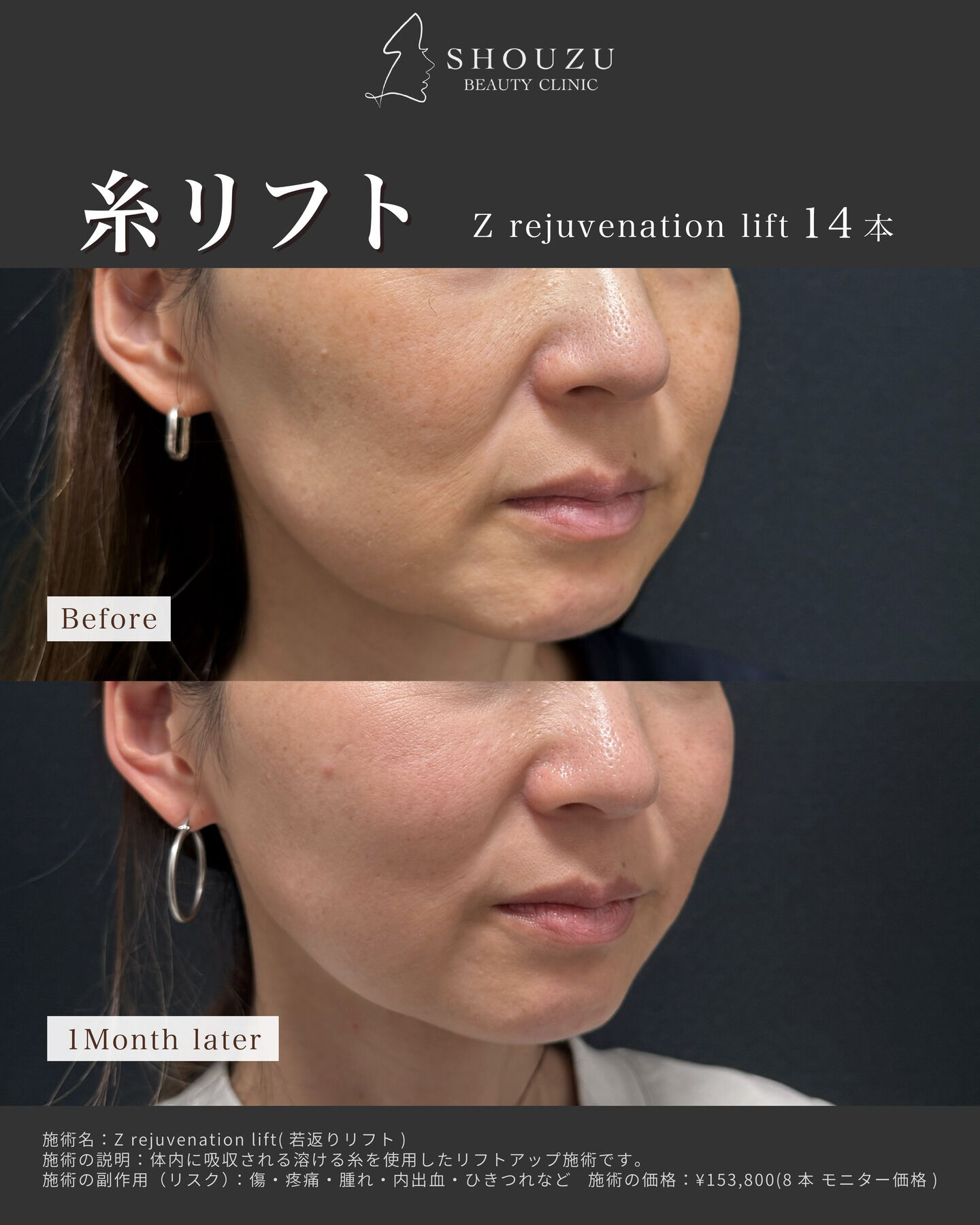 .40代 モニター様のご紹介です