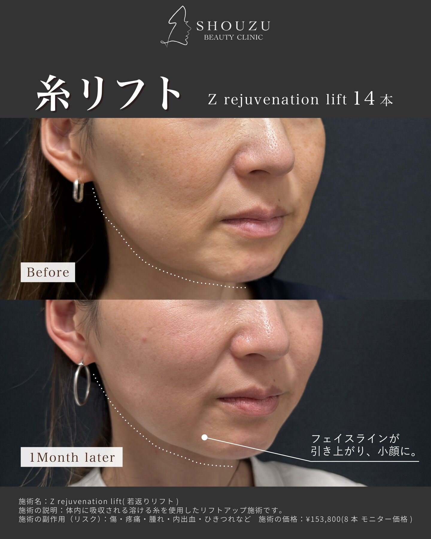 .40代 モニター様のご紹介です