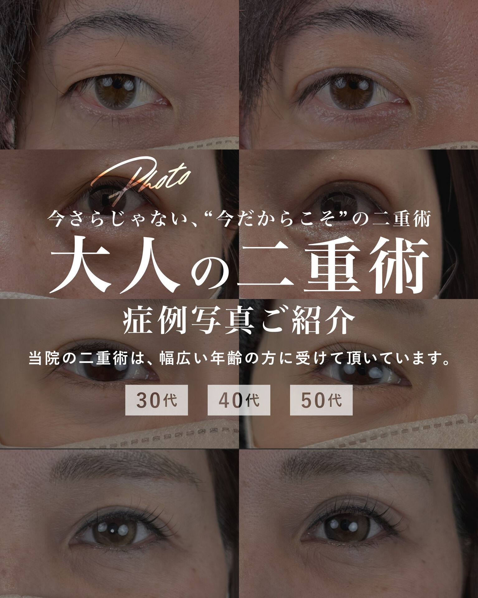 年齢とともに変化する目元
