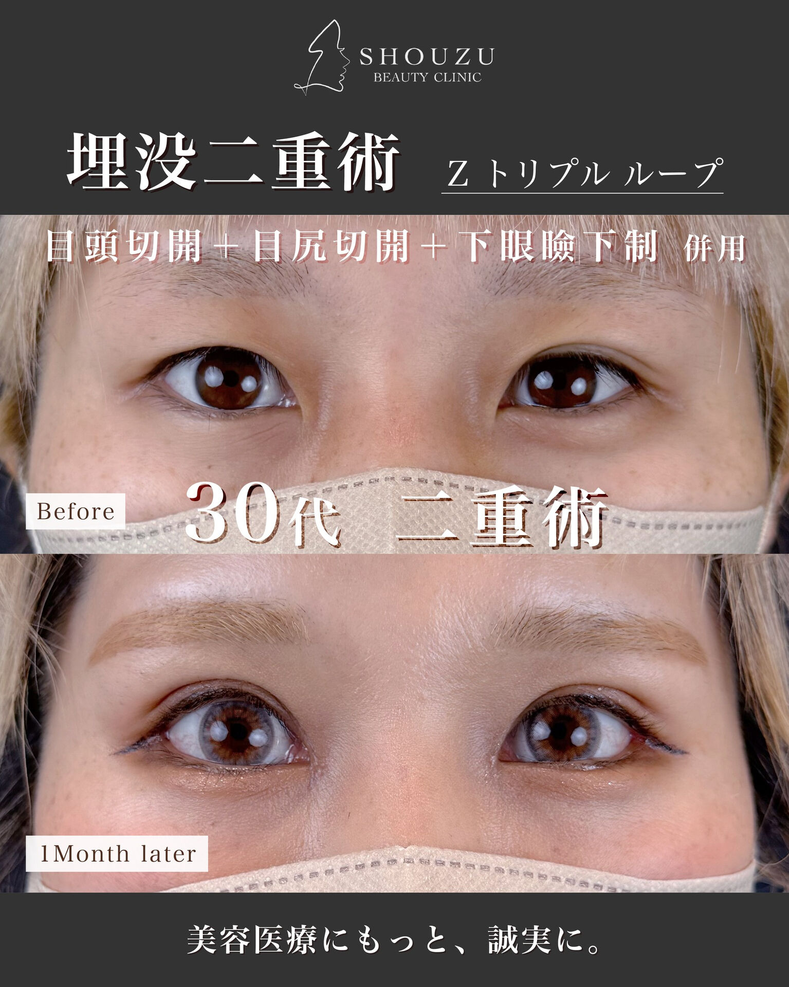 年齢とともに変化する目元