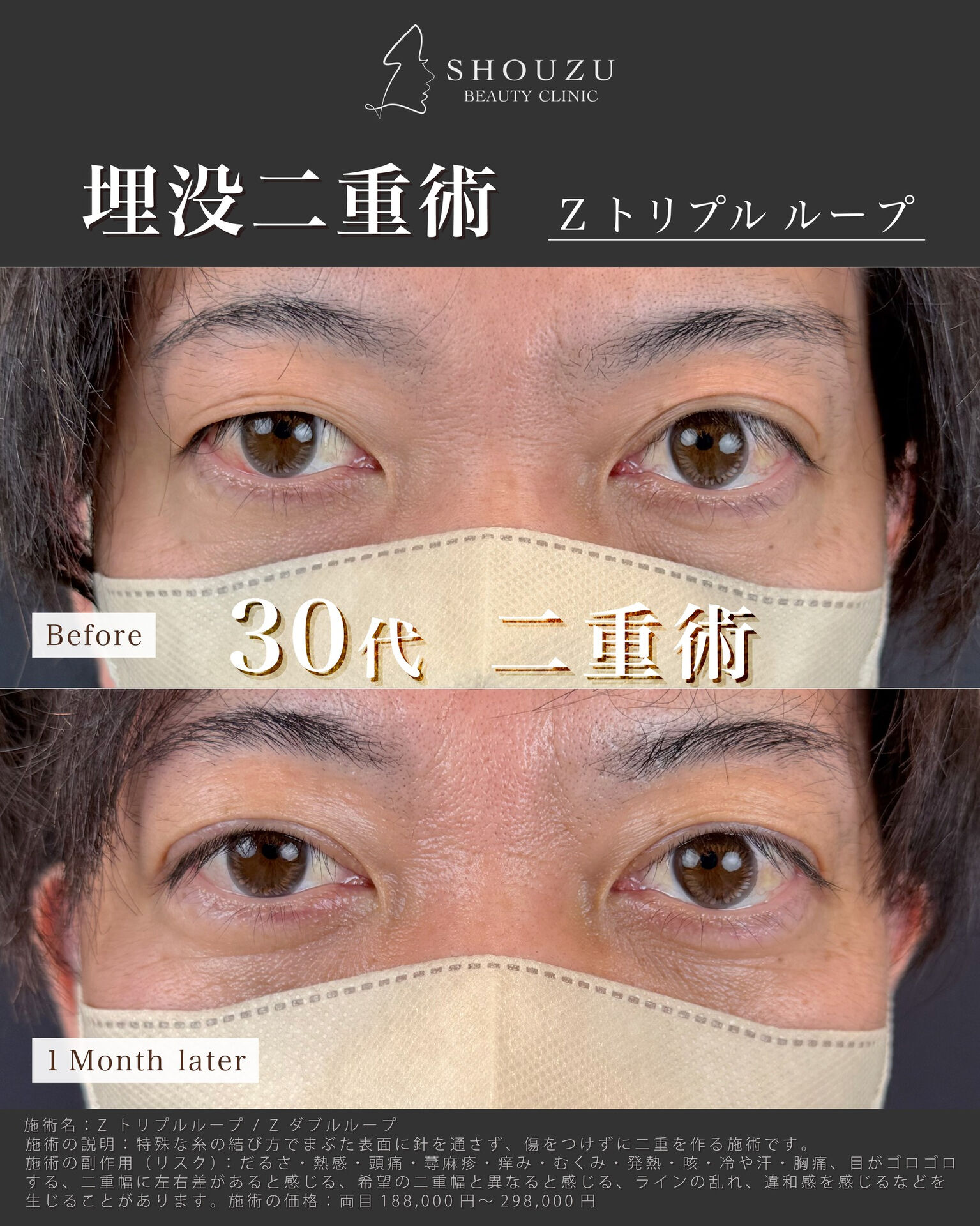 年齢とともに変化する目元