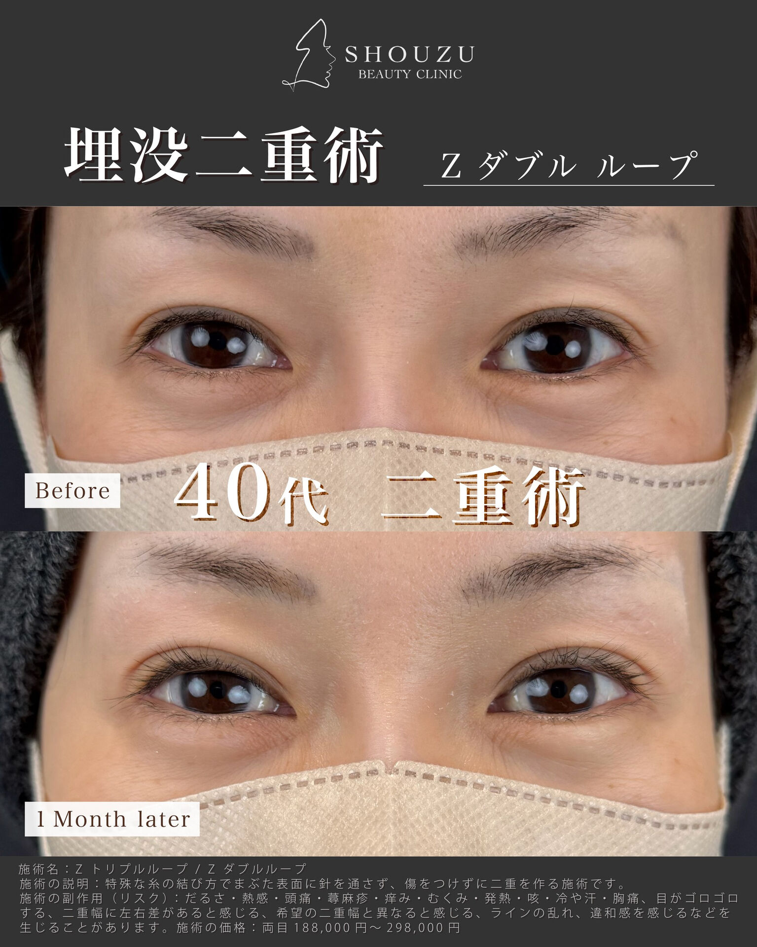 年齢とともに変化する目元