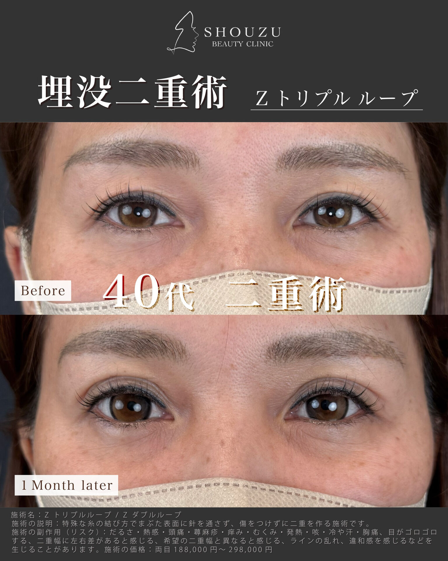 年齢とともに変化する目元