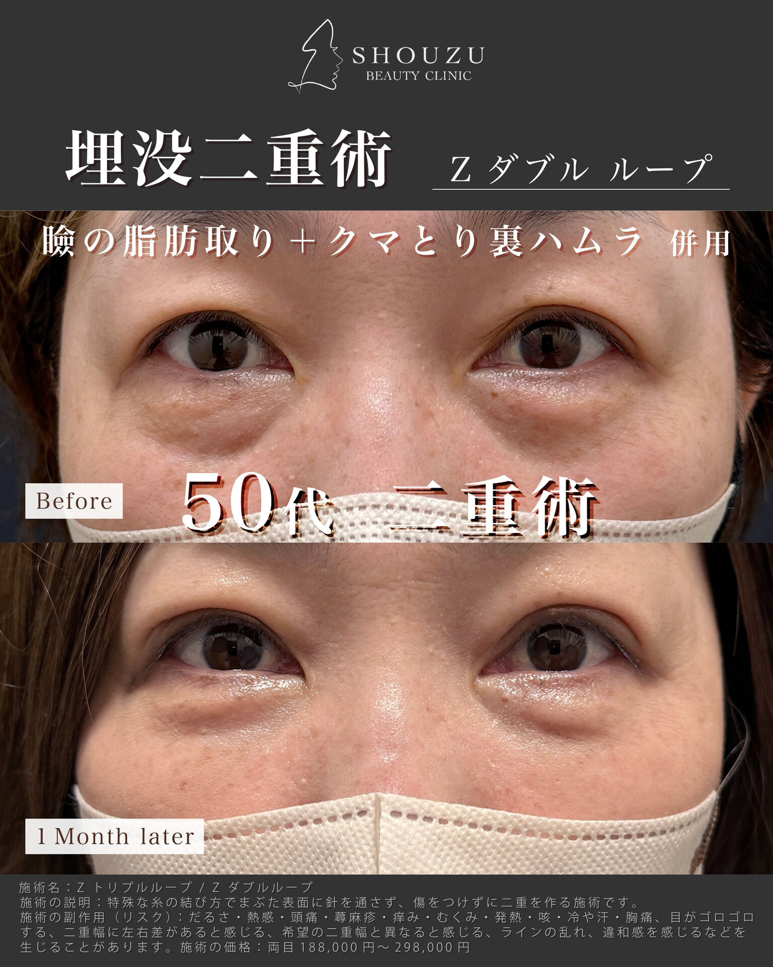 年齢とともに変化する目元