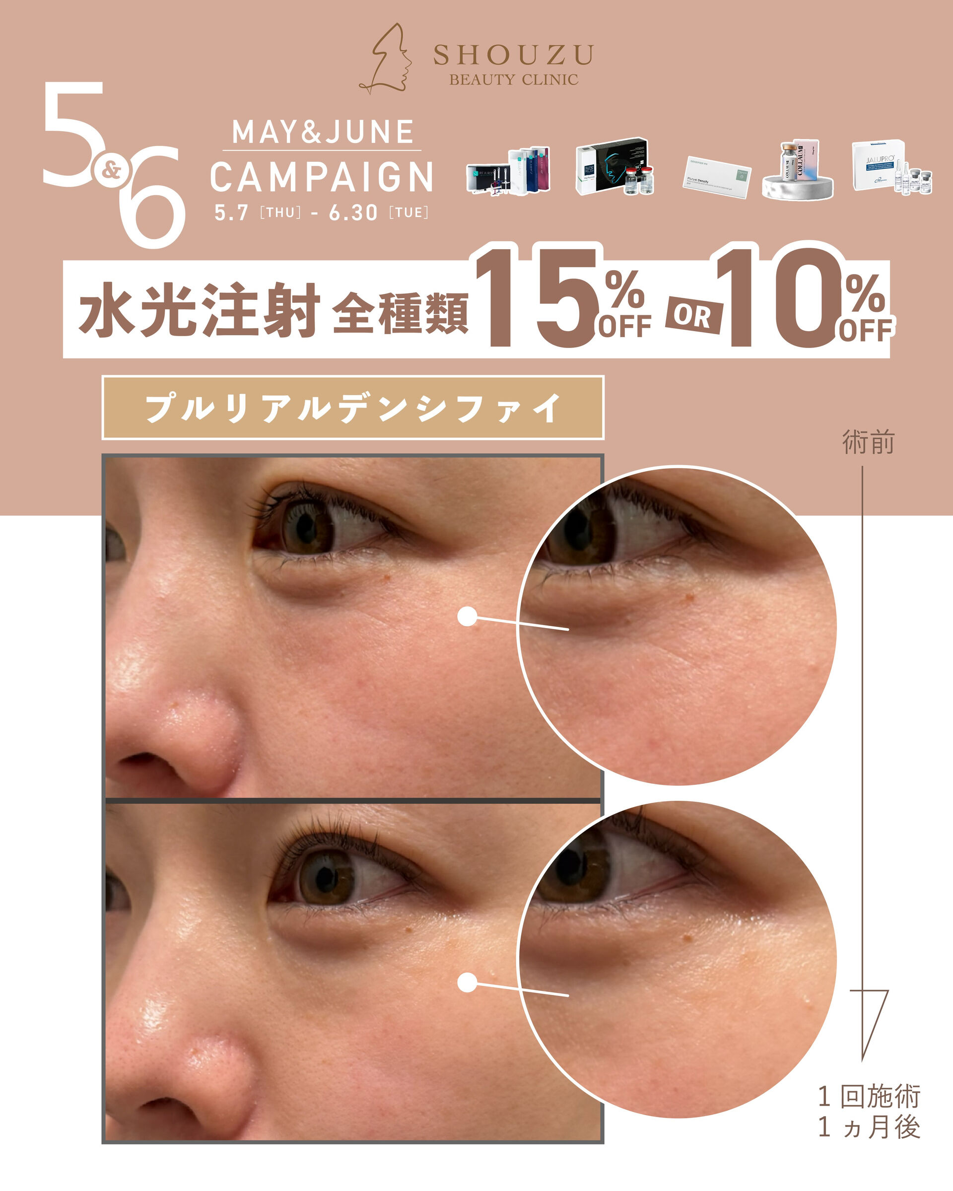 ＼5・6月限定🌿水光注射キャンペーン／