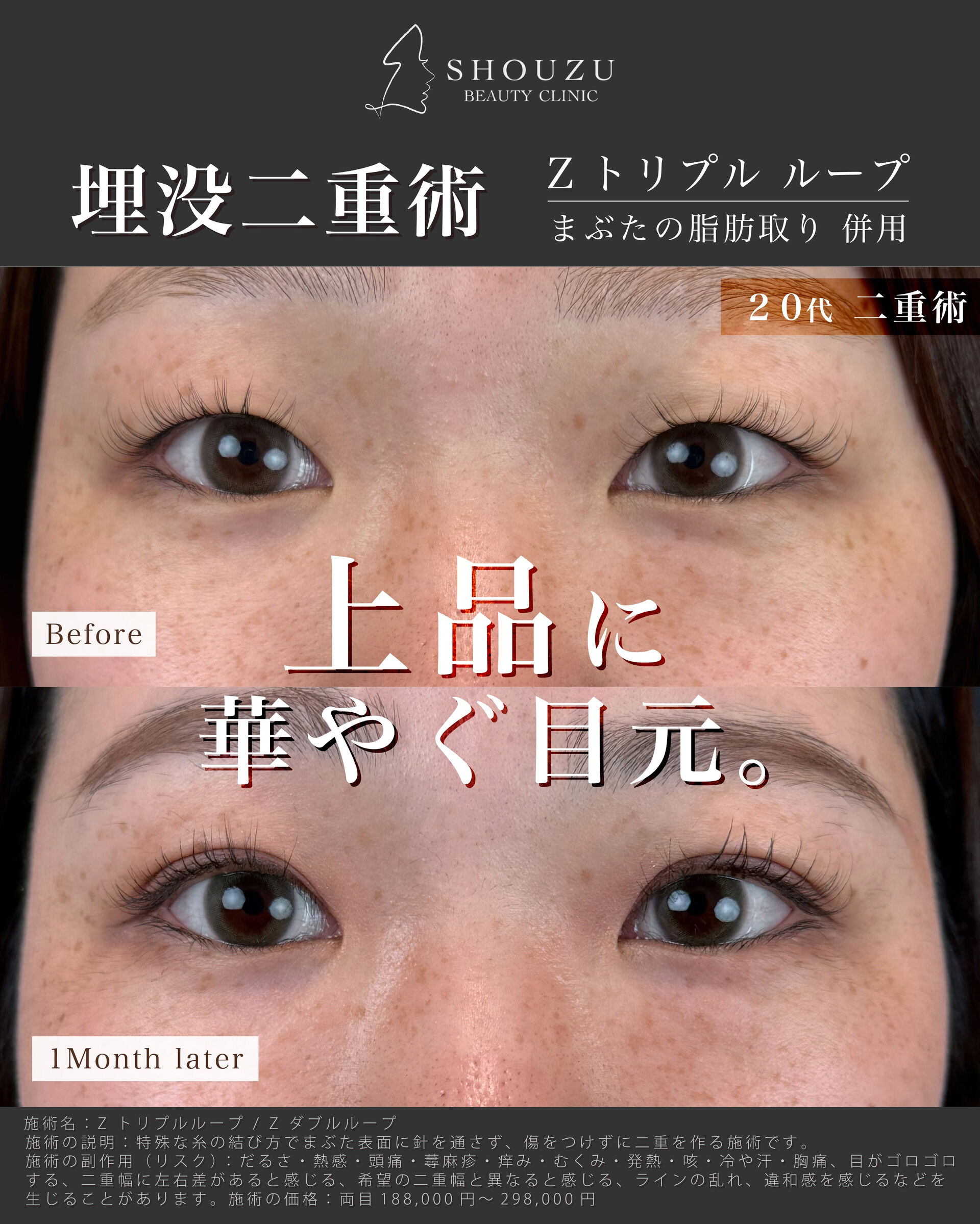 こちらは20代 女性モニターのお客様です