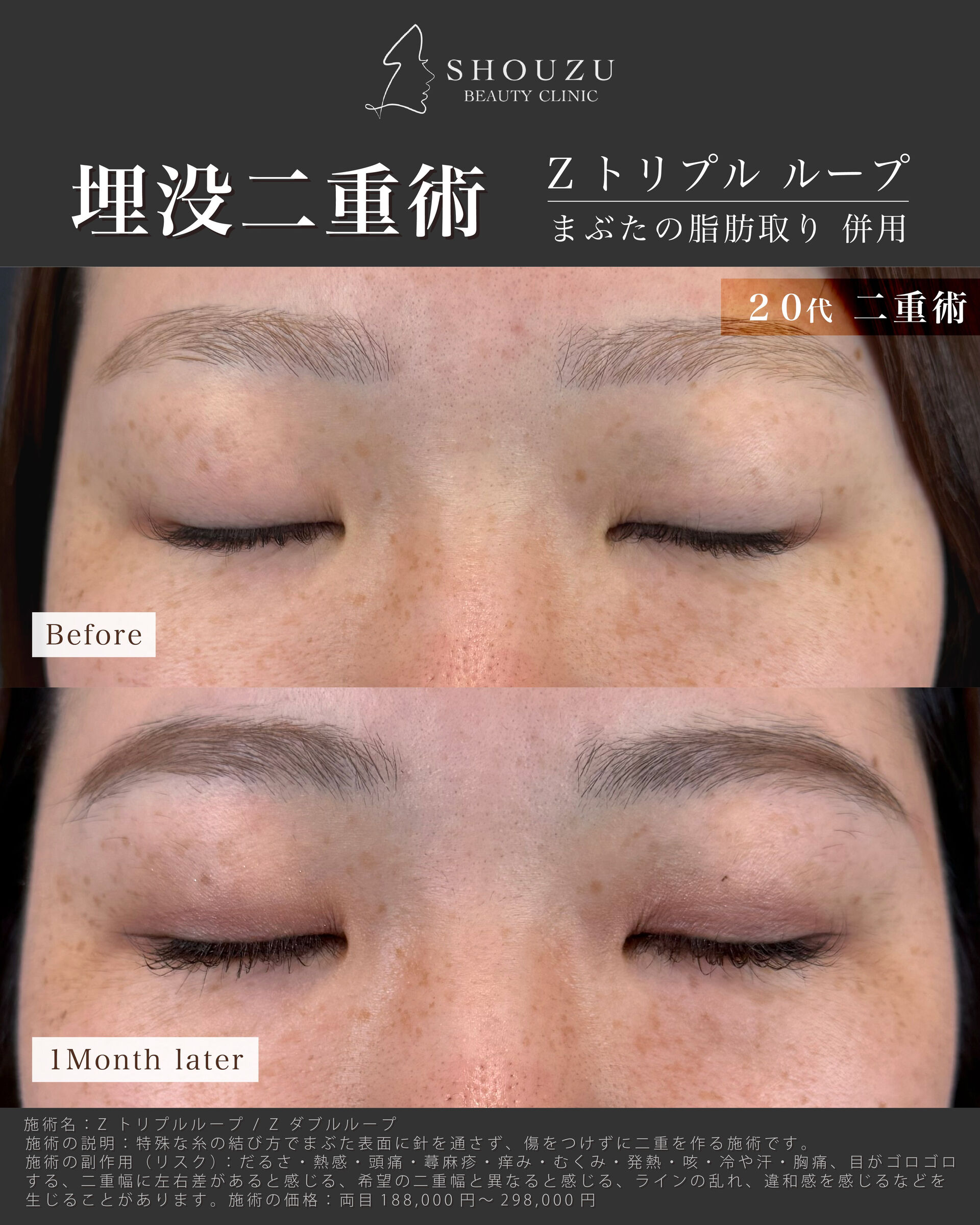 こちらは20代 女性モニターのお客様です