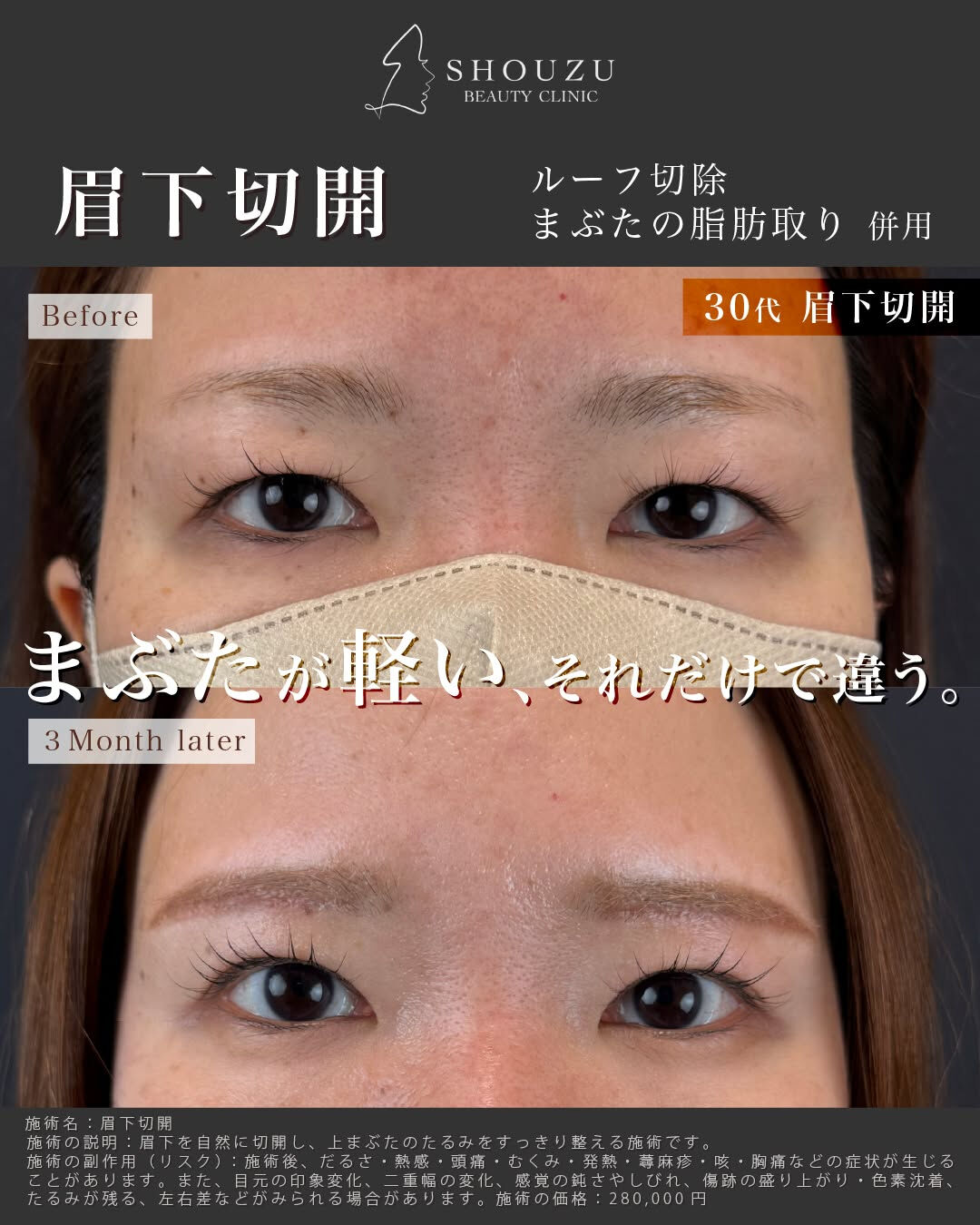こちらは30代 女性モニターのお客様です