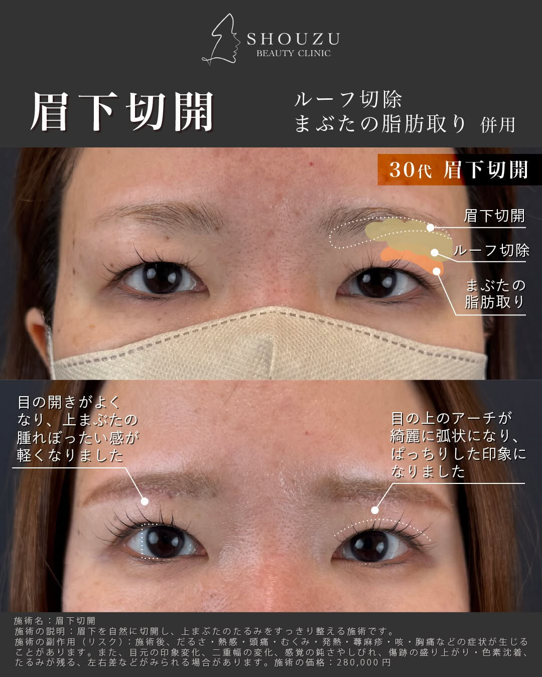 こちらは30代 女性モニターのお客様です