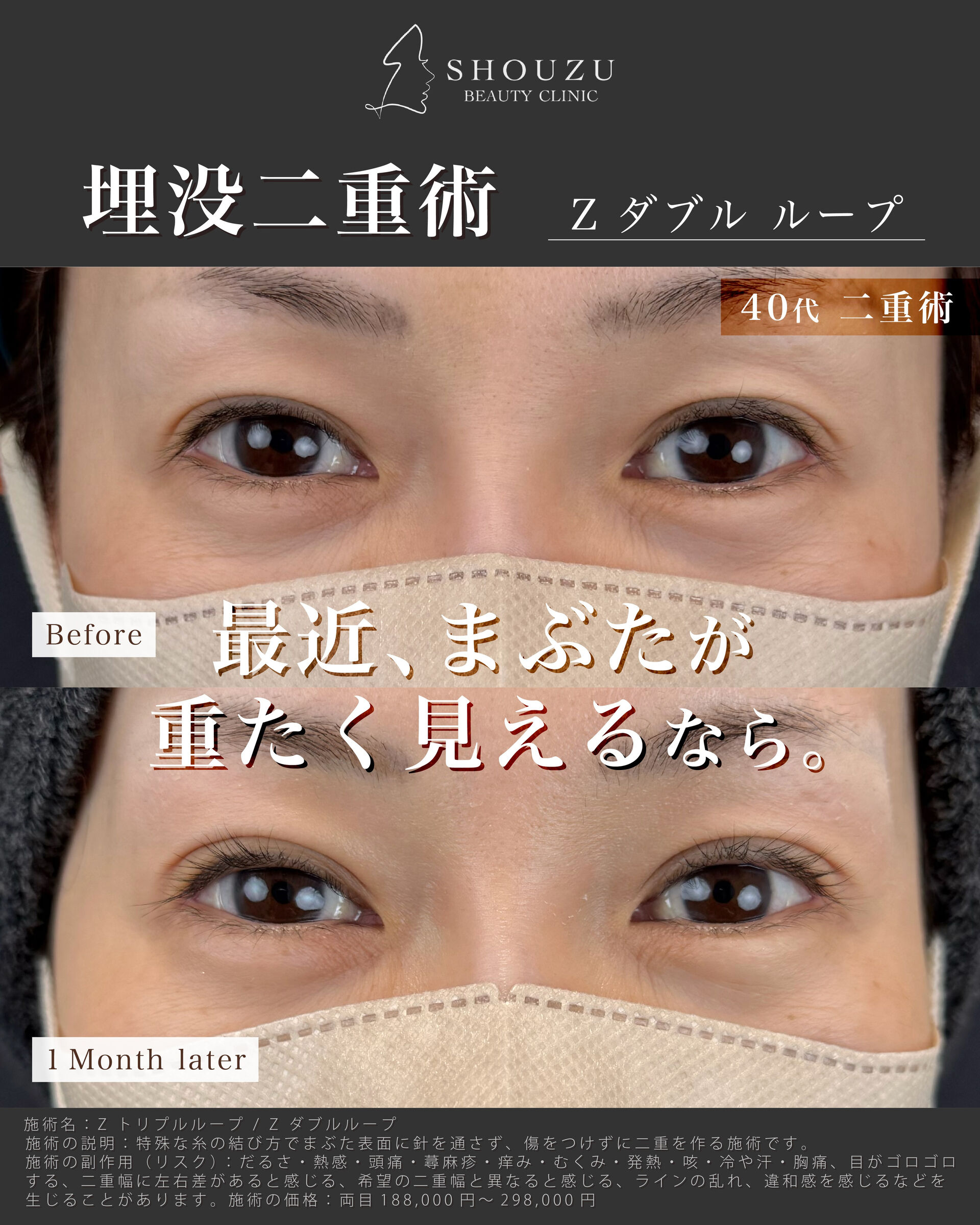 こちらは40代 女性モニターのお客様です