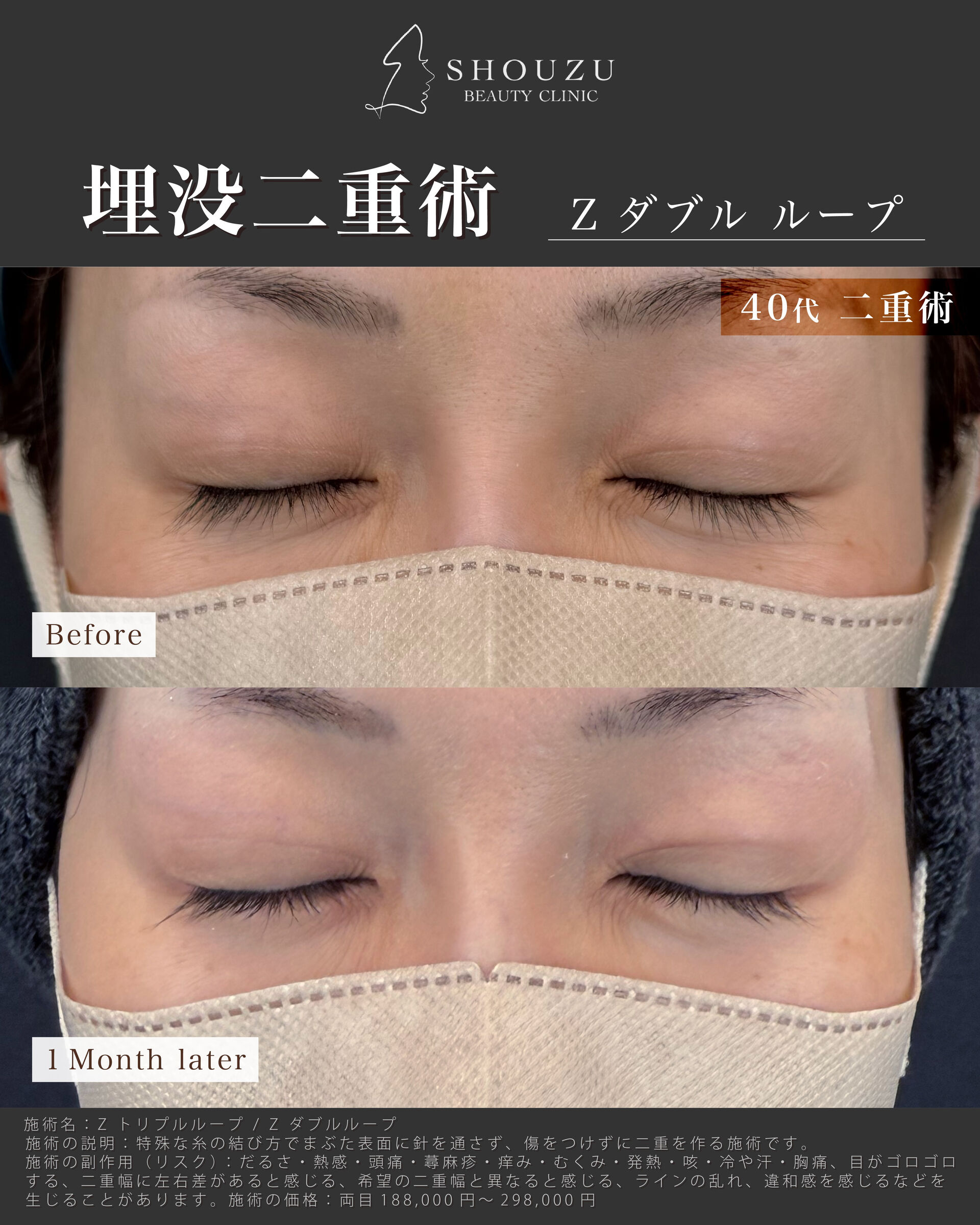 こちらは40代 女性モニターのお客様です