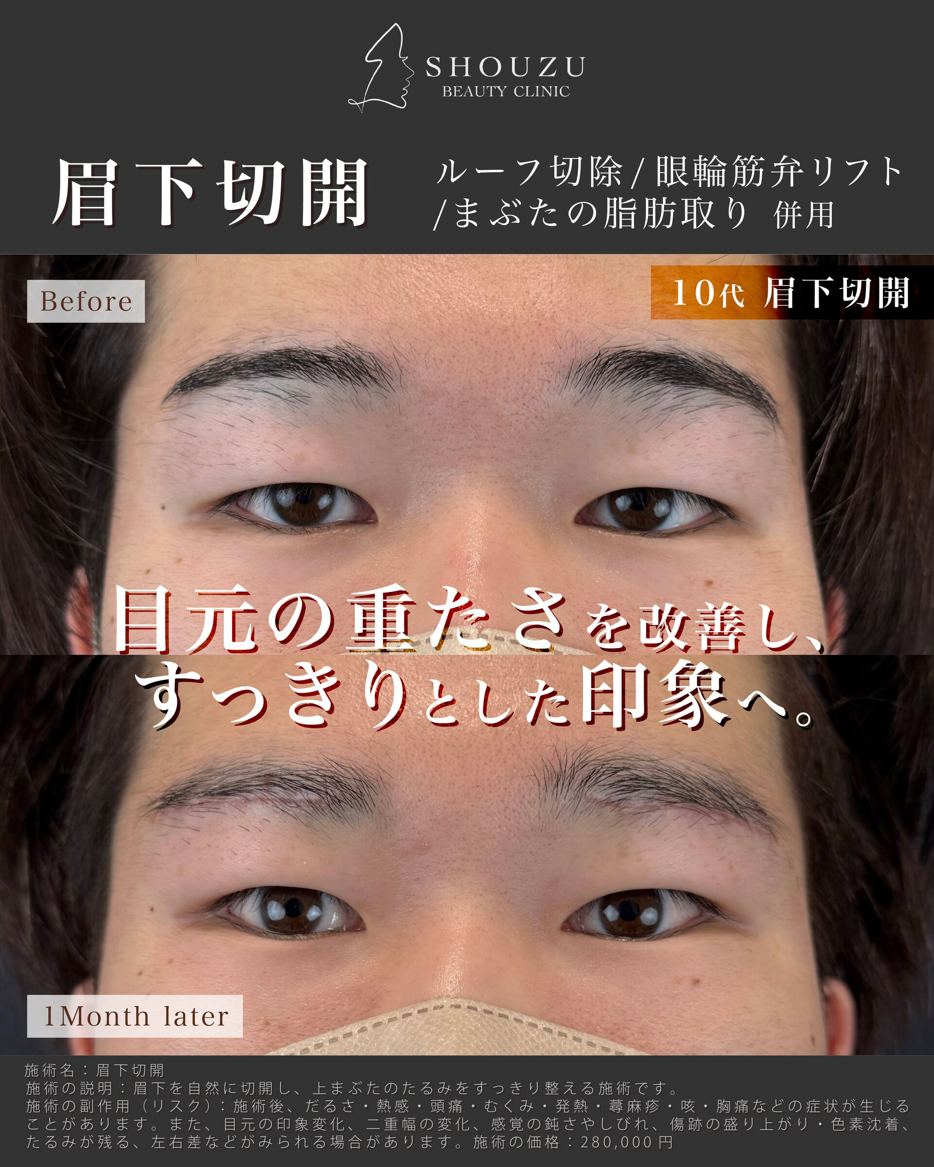 multi_image