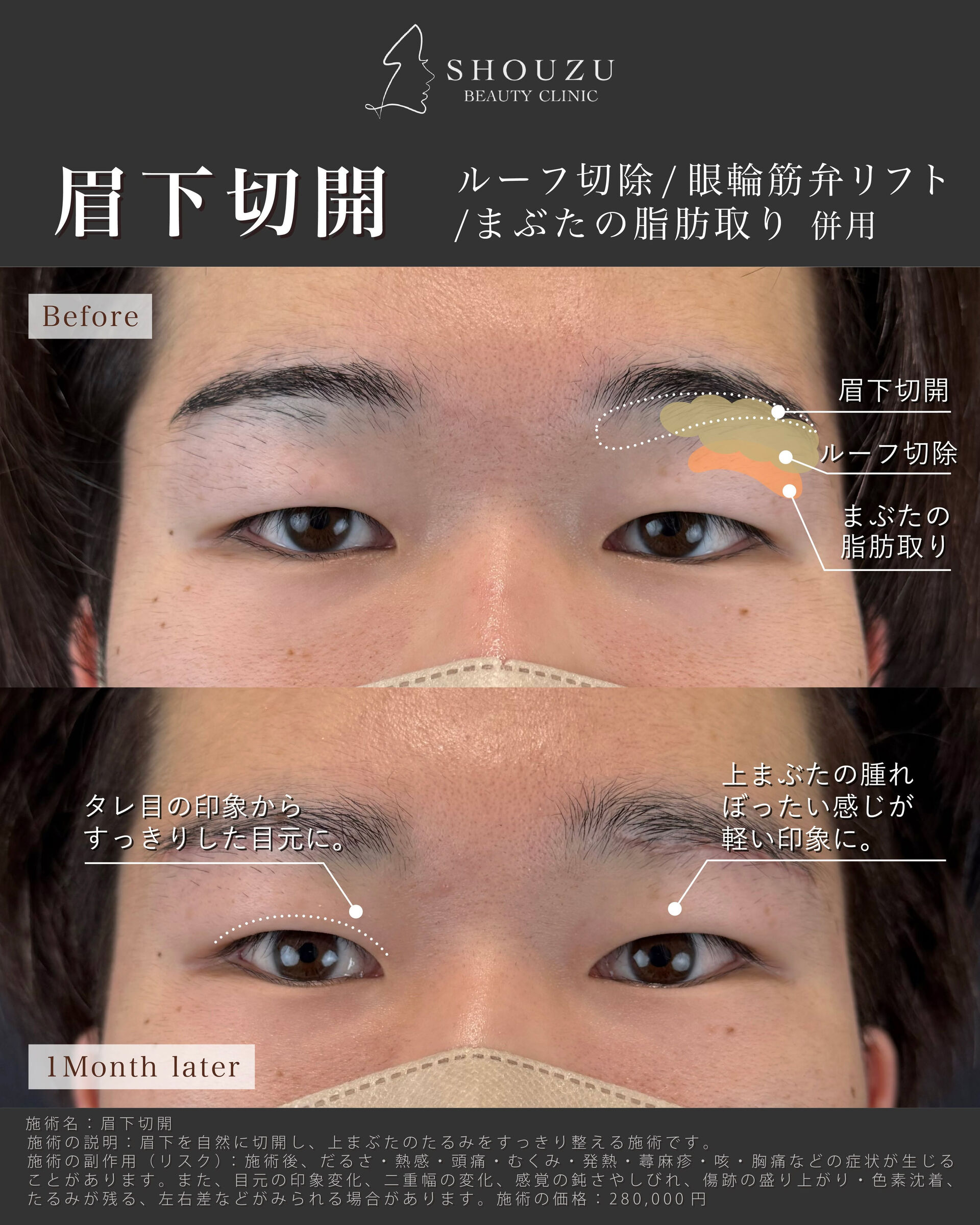 multi_image