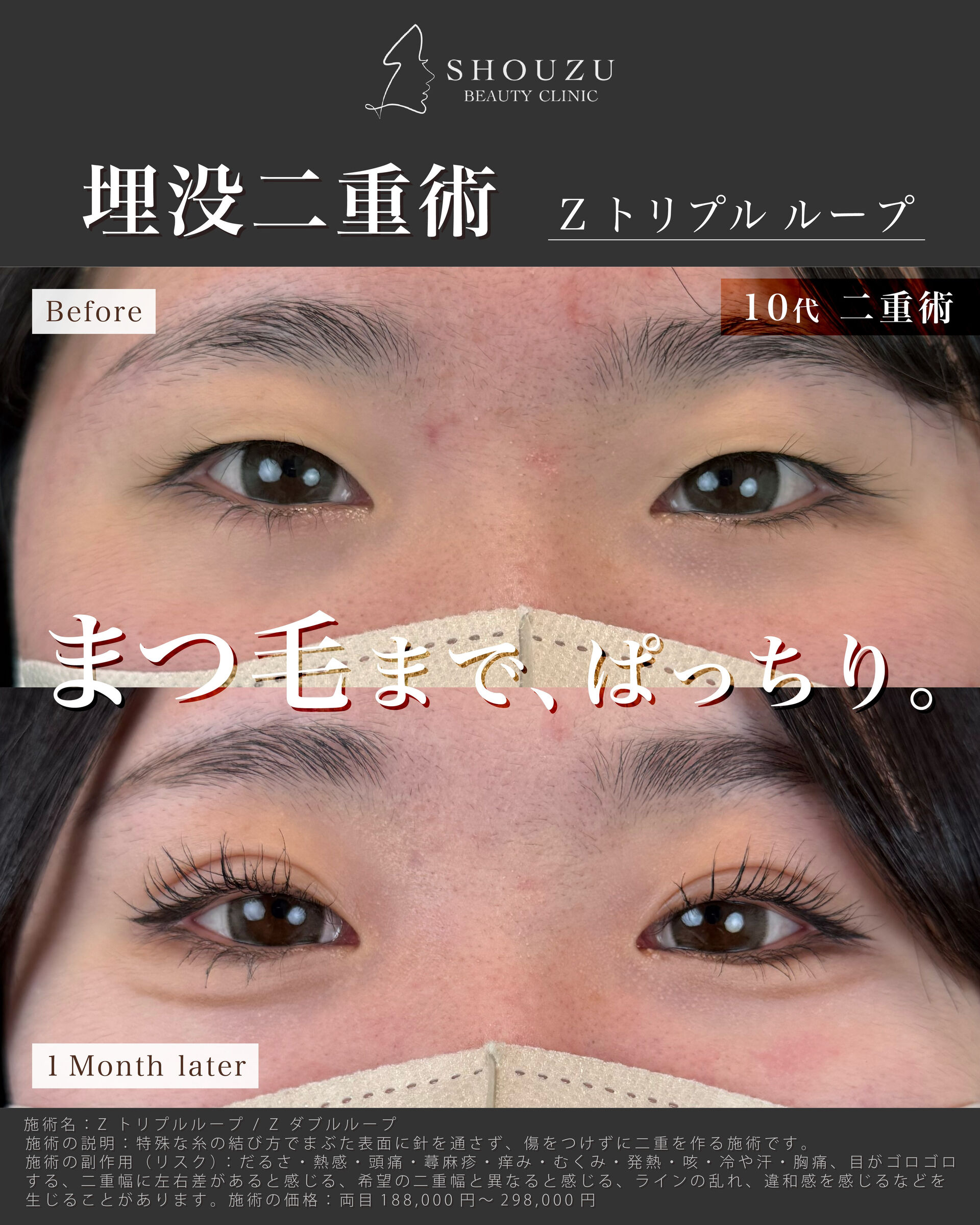 こちらは10代 女性モニターのお客様です