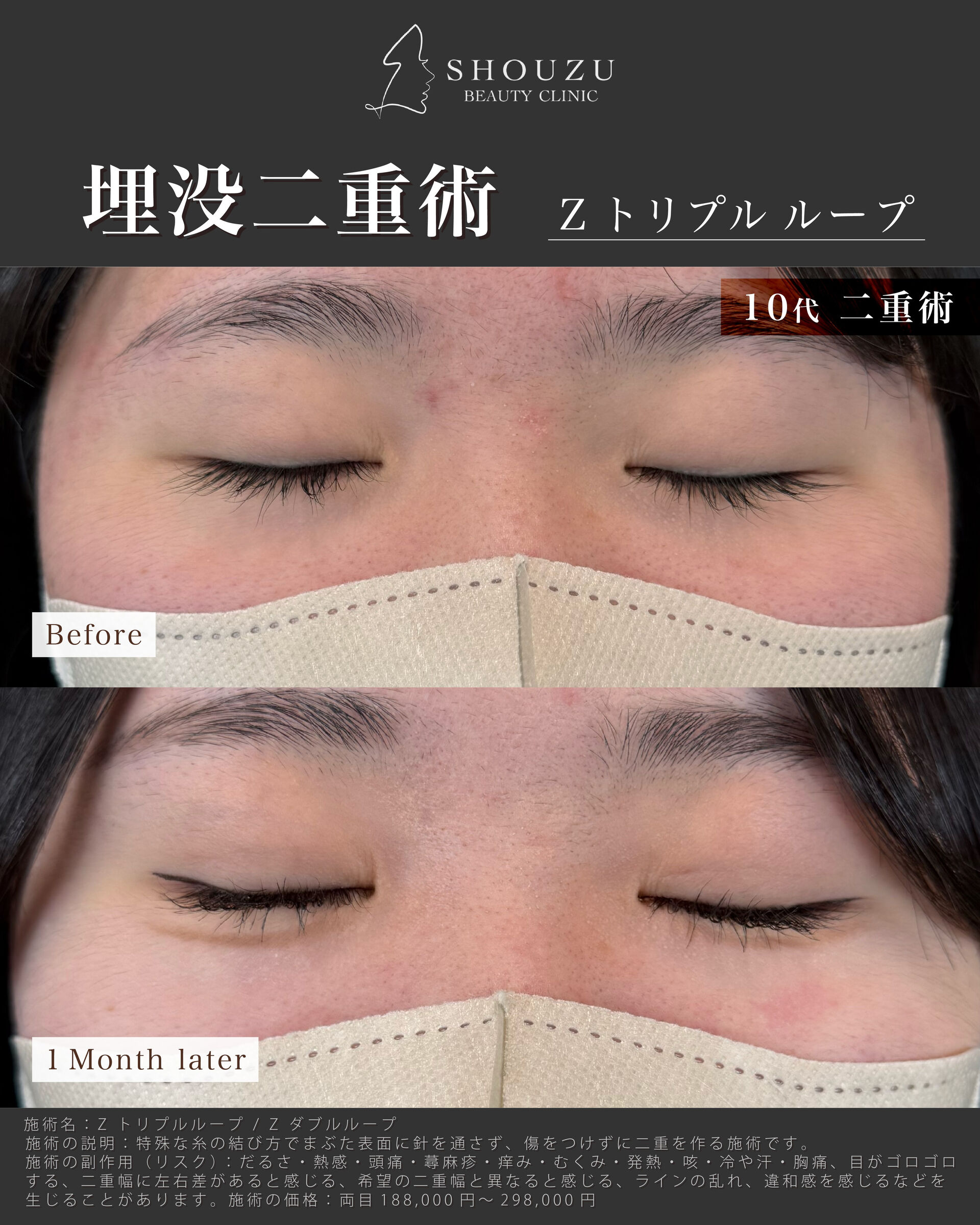 こちらは10代 女性モニターのお客様です