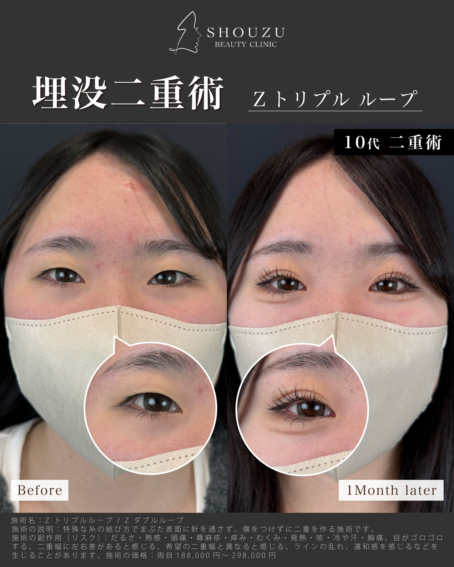 こちらは10代 女性モニターのお客様です