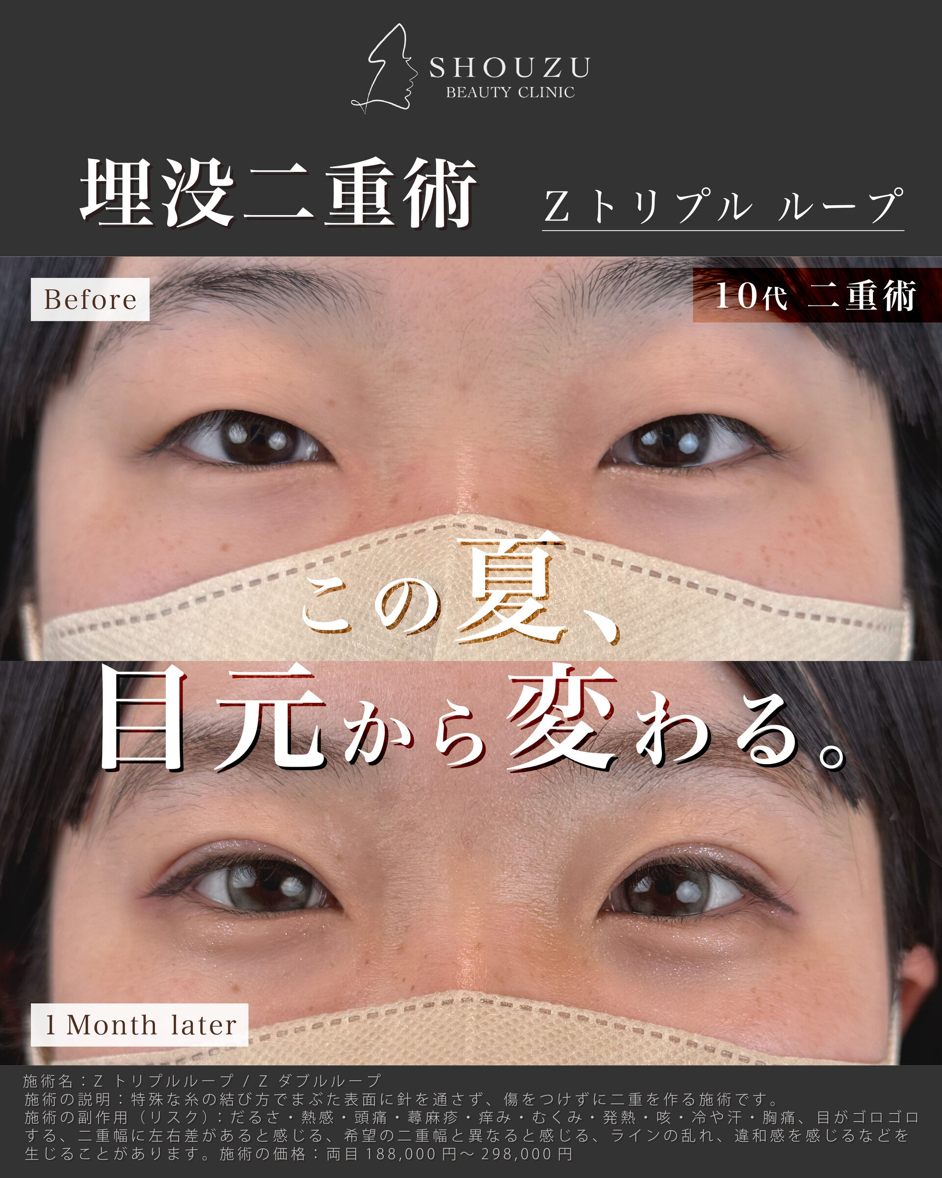 こちらは10代 女性モニターのお客様です